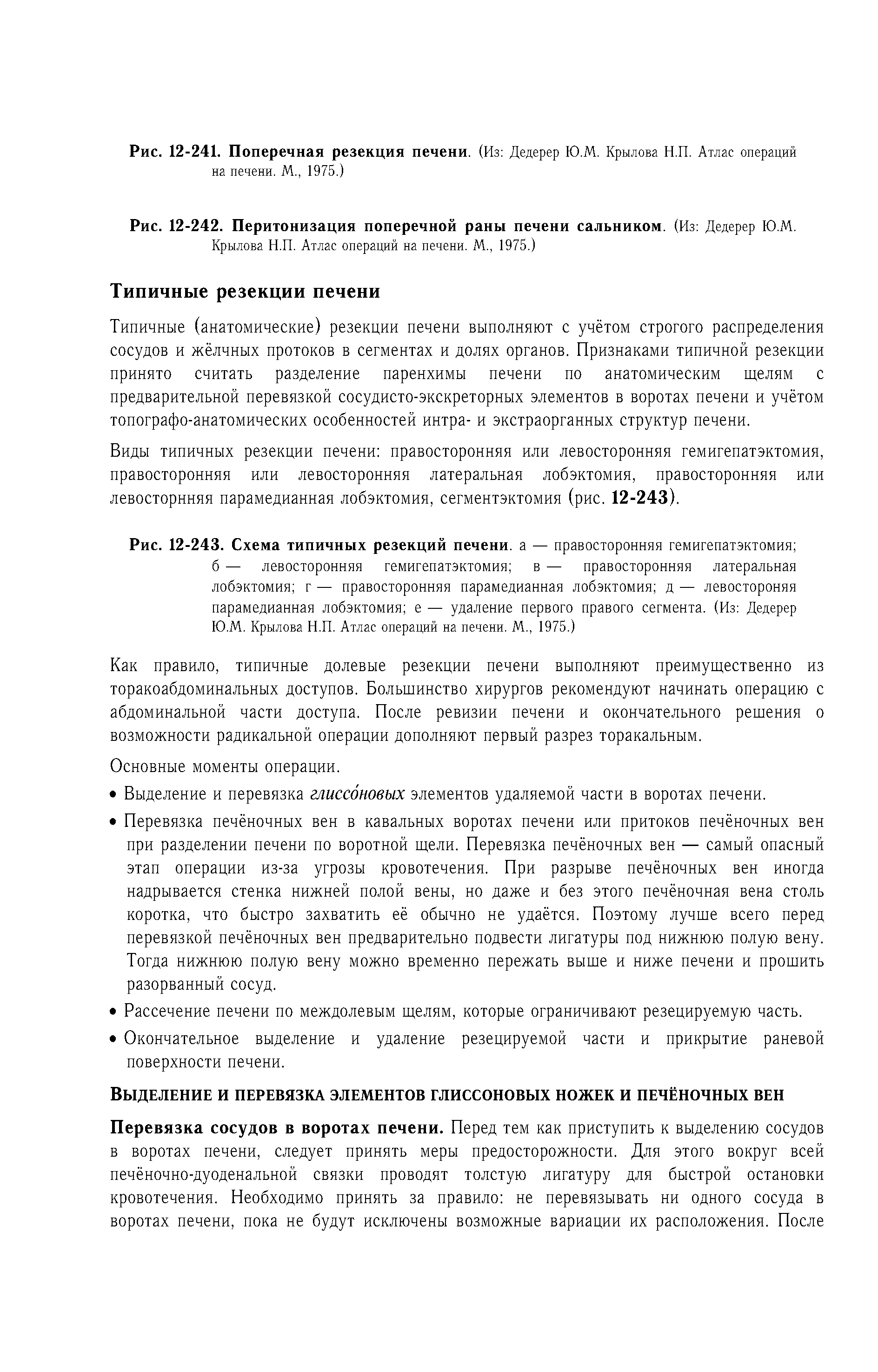 Рис. 12-243. Схема типичных резекций печени, а — правосторонняя гемигепатэктомия ...