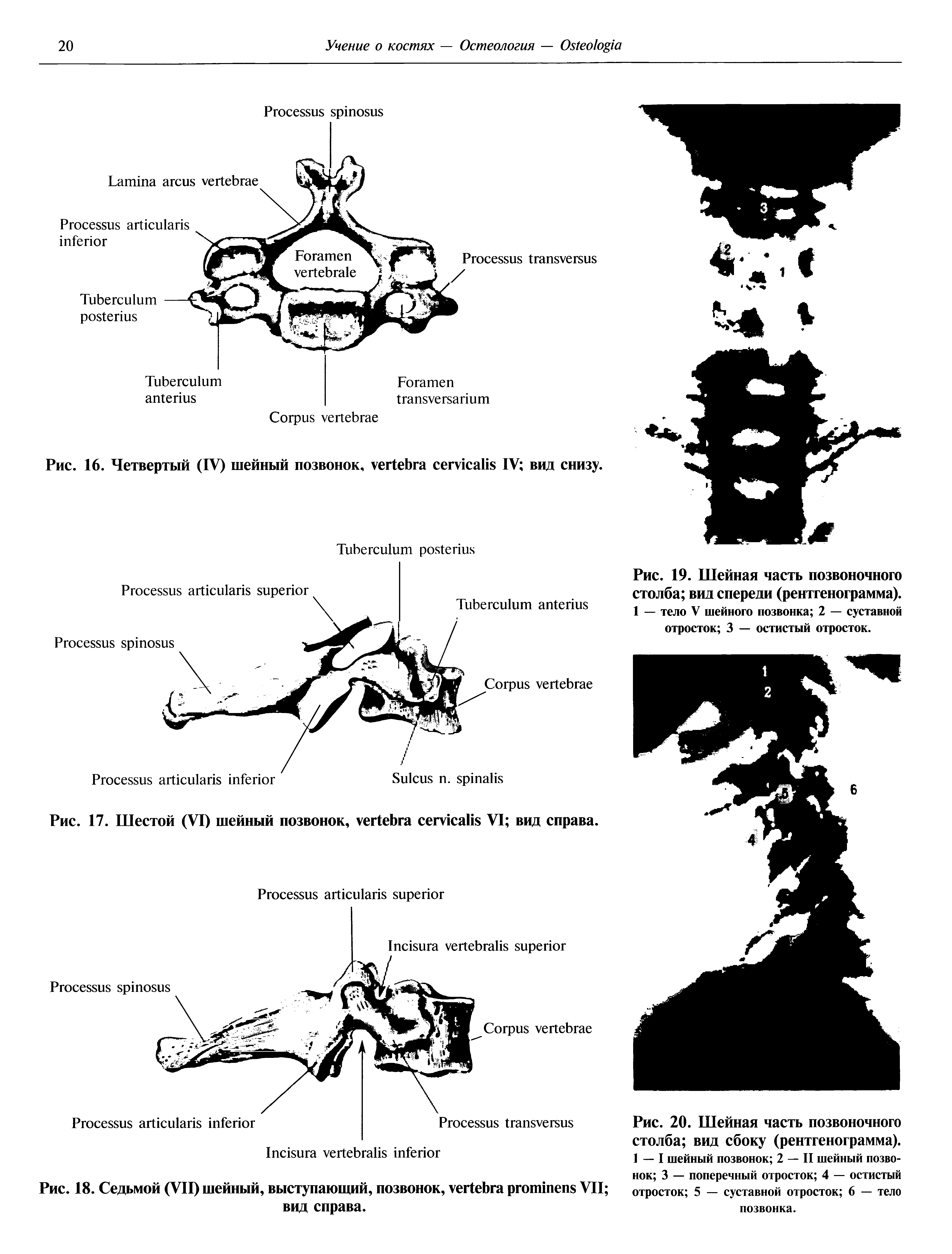 Рис. 18. Седьмой (VII) шейный, выступающий, позвонок, VII вид справа.