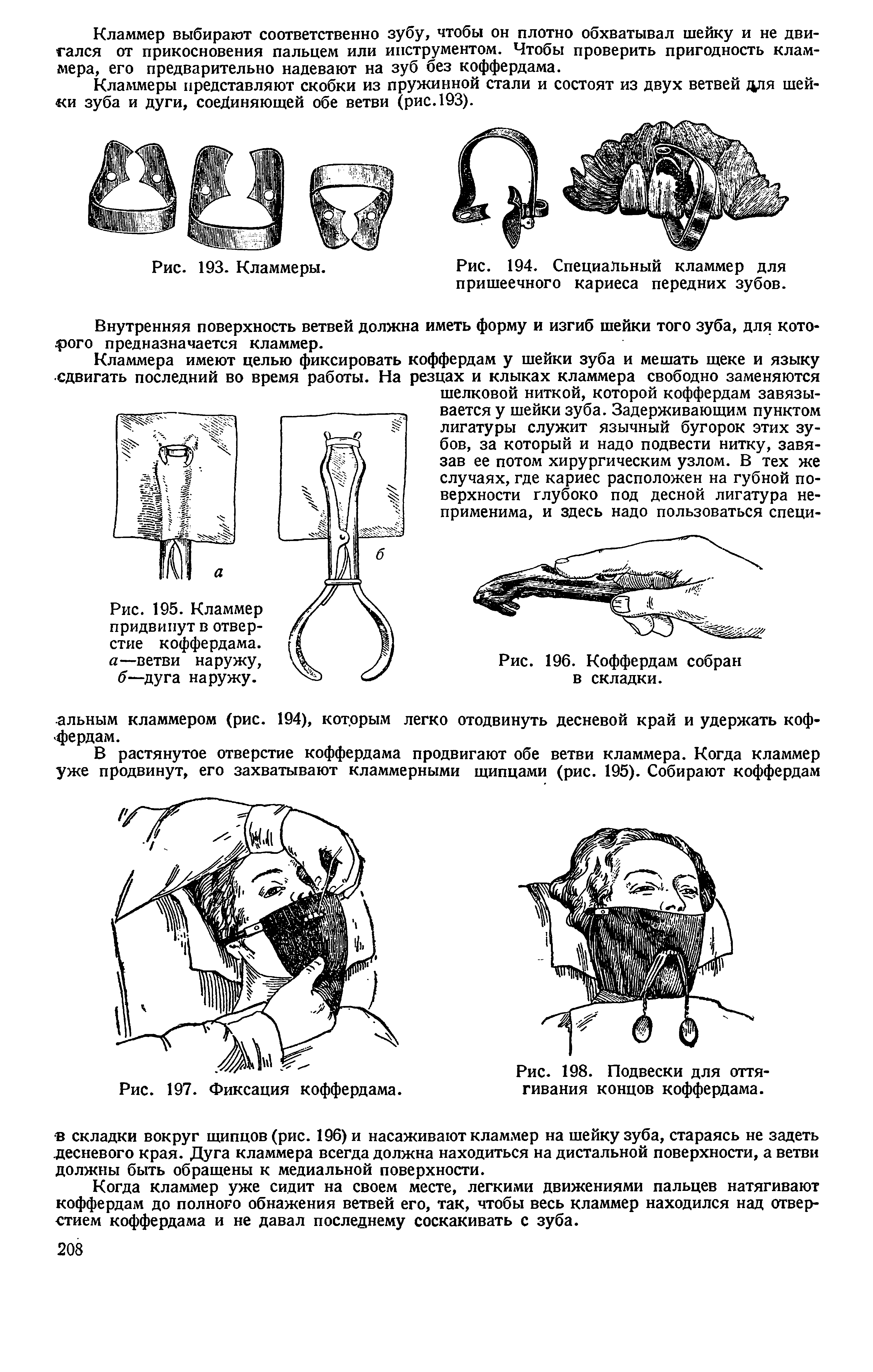 Рис. 194. Специальный кламмер для пришеечного кариеса передних зубов.