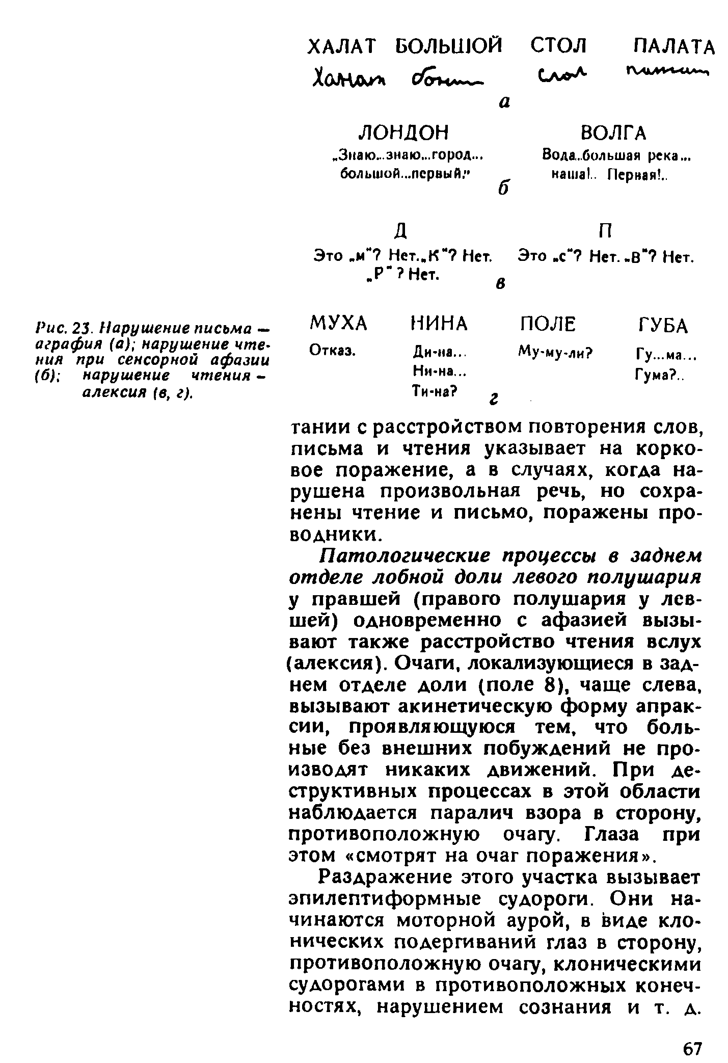 Рис. 23. Нарушение письма — МУХА НИНА ПОДЕ ГУБА...