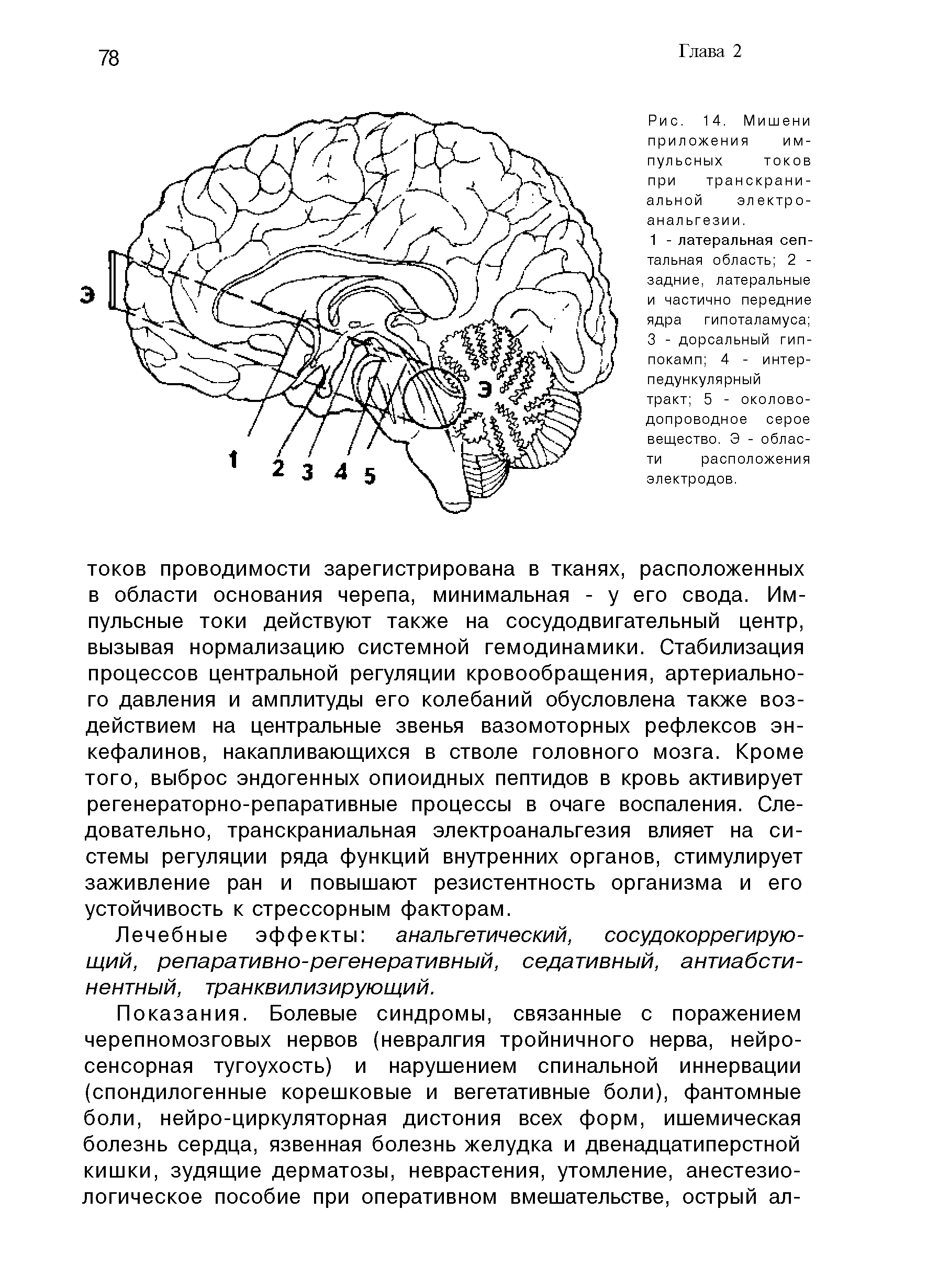 Рис. 14. Мишени приложения импульсных токов при транскраниальной электроанальгезии.