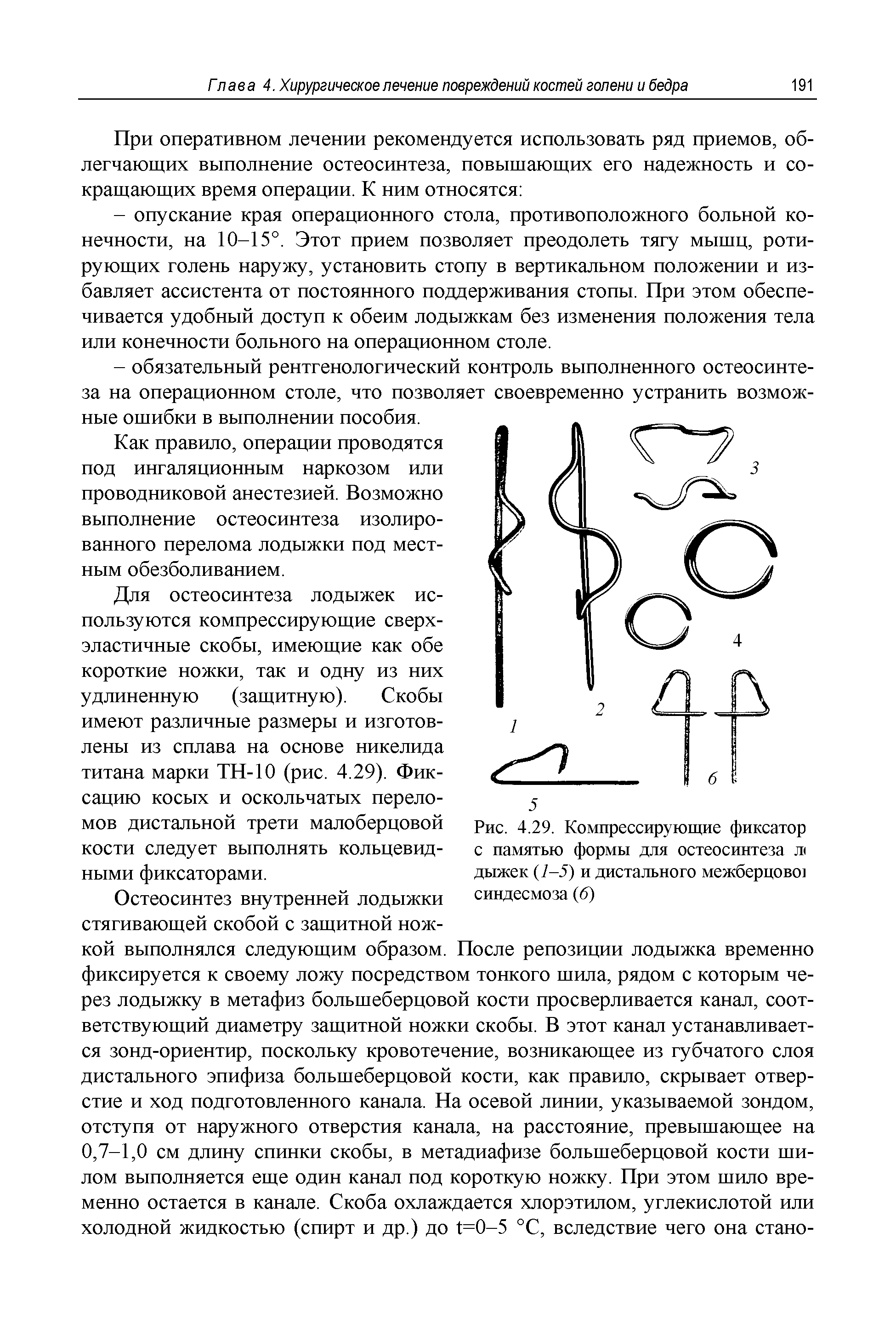 Рис. 4.29. Компрессирующие фиксатор с памятью формы для остеосинтеза л< дыжек (1-5) и дистального межберцово) синдесмоза (6)...