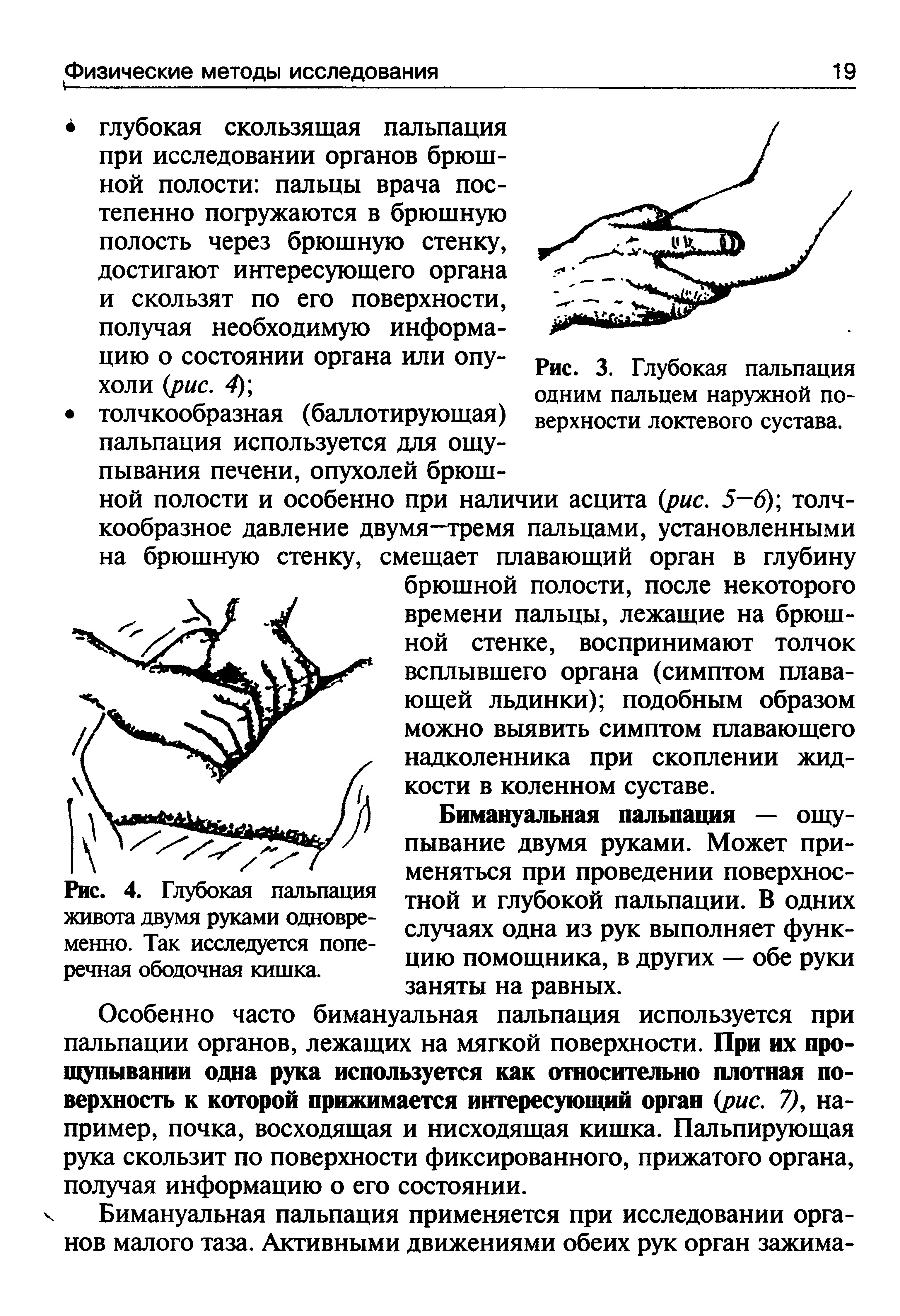 Рис. 4. Глубокая пальпация живота двумя руками одновременно. Так исследуется поперечная ободочная кишка.