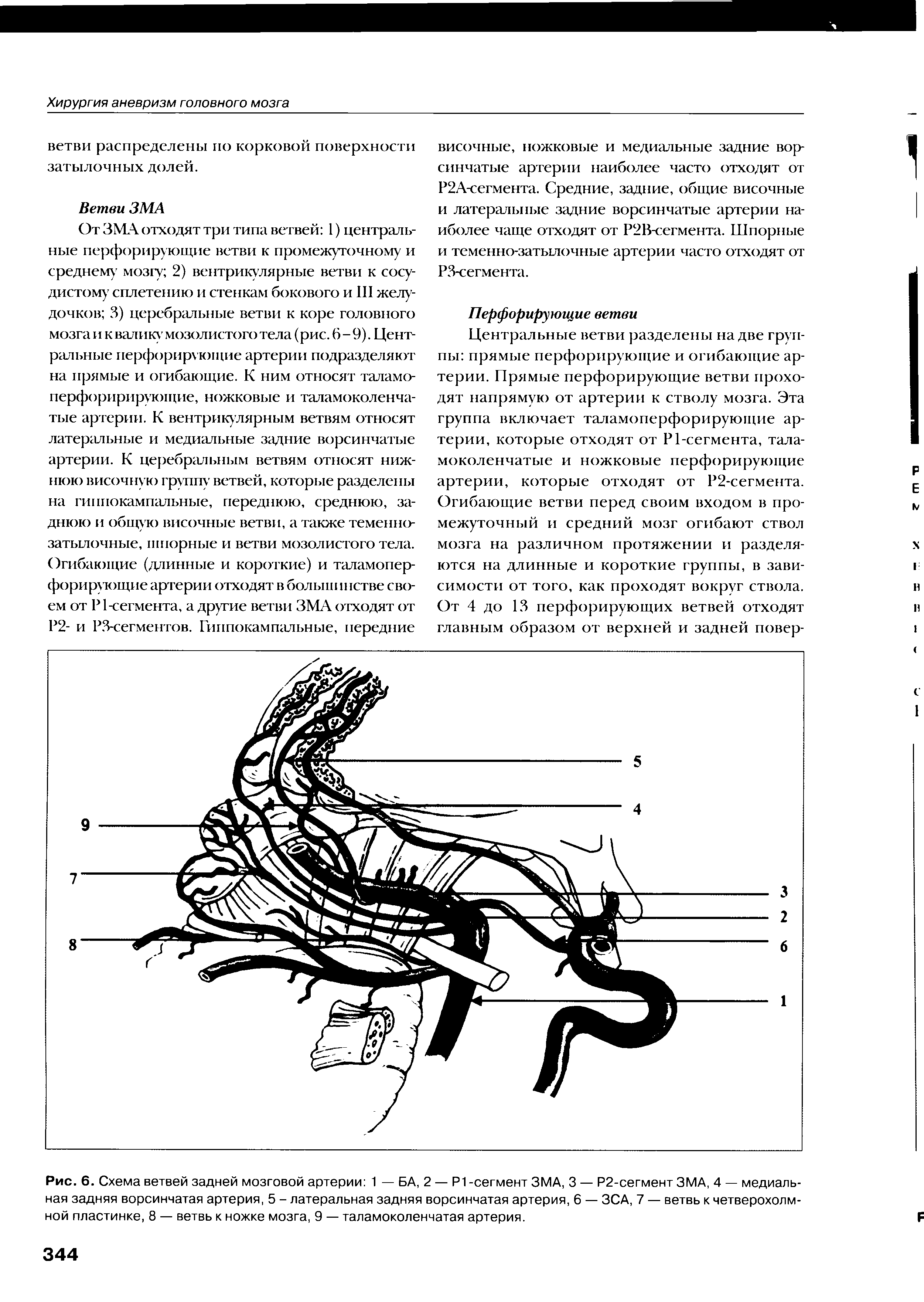 Рис. 6. Схема ветвей задней мозговой артерии 1 — БА, 2 — Р1 -сегмент ЗМА, 3 — Р2-сегмент ЗМА, 4 — медиальная задняя ворсинчатая артерия, 5 - латеральная задняя ворсинчатая артерия, 6 — ЗСА, 7 — ветвь к четверохолмной пластинке, 8 — ветвь к ножке мозга, 9 — таламоколенчатая артерия.