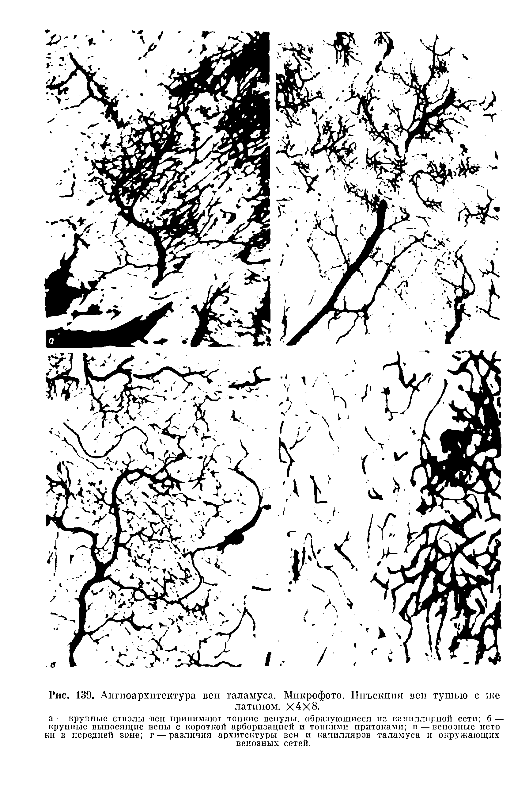 Рис. 139. Апгпоархитектура вен таламуса. Микрофото. Инъекция вей тушыо с желатином. Х4х8.