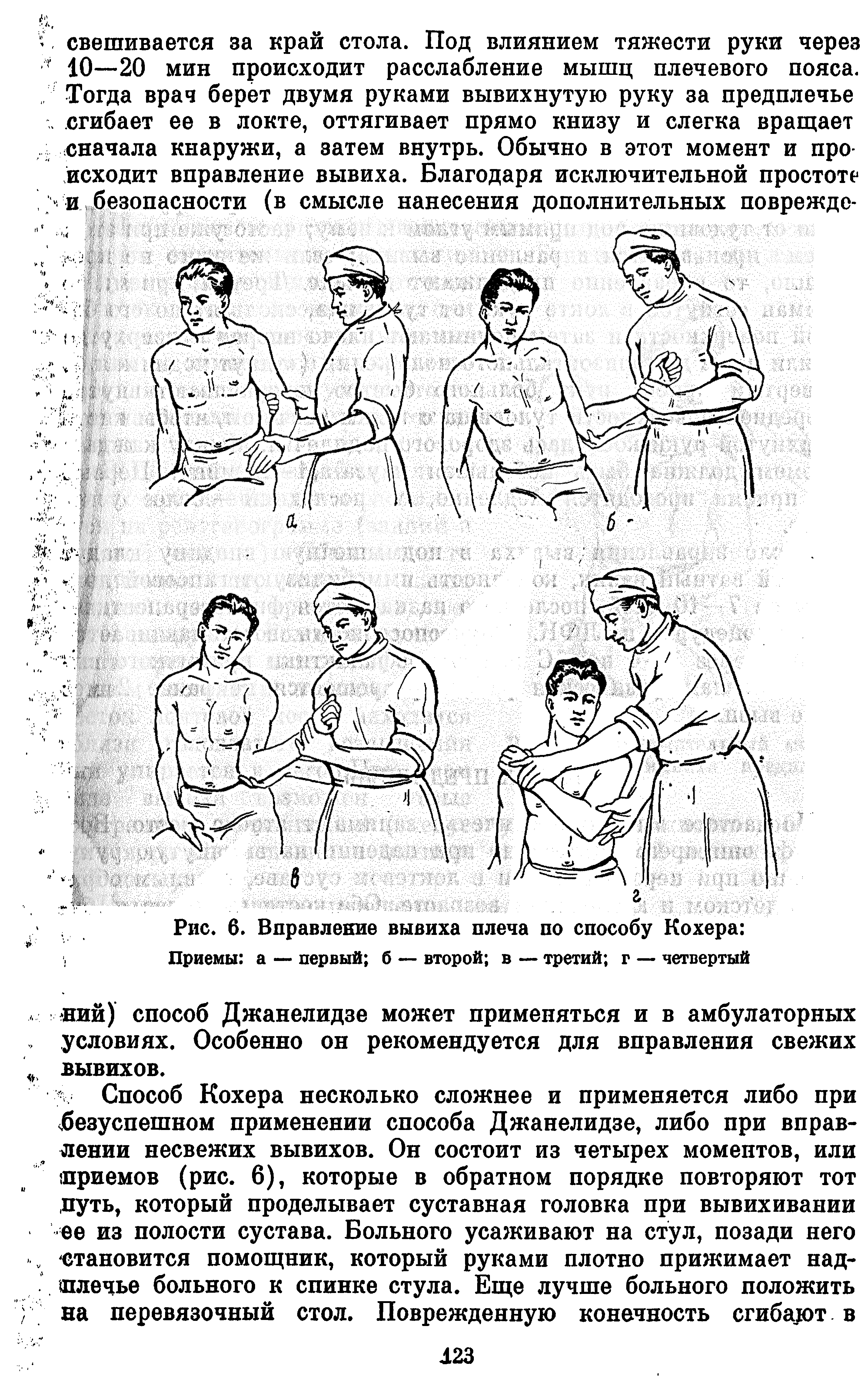 Рис. 6. Вправление вывиха плеча по способу Кохера Приемы а — первый б — второй в — третий г — четвертый...