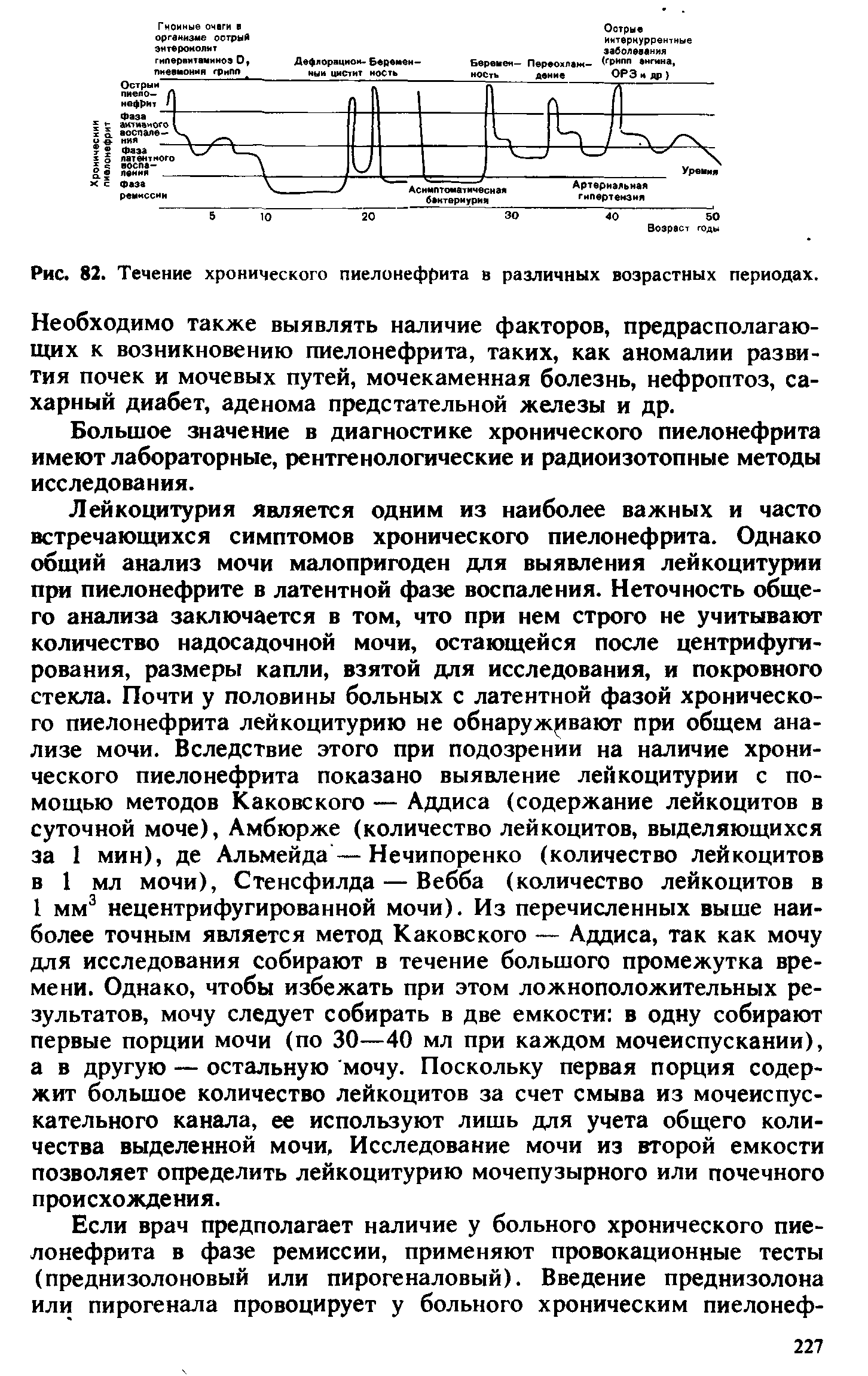 Рис. 82. Течение хронического пиелонефрита в различных возрастных периодах. Необходимо также выявлять наличие факторов, предрасполагающих к возникновению пиелонефрита, таких, как аномалии развития почек и мочевых путей, мочекаменная болезнь, нефроптоз, сахарный диабет, аденома предстательной железы и др.