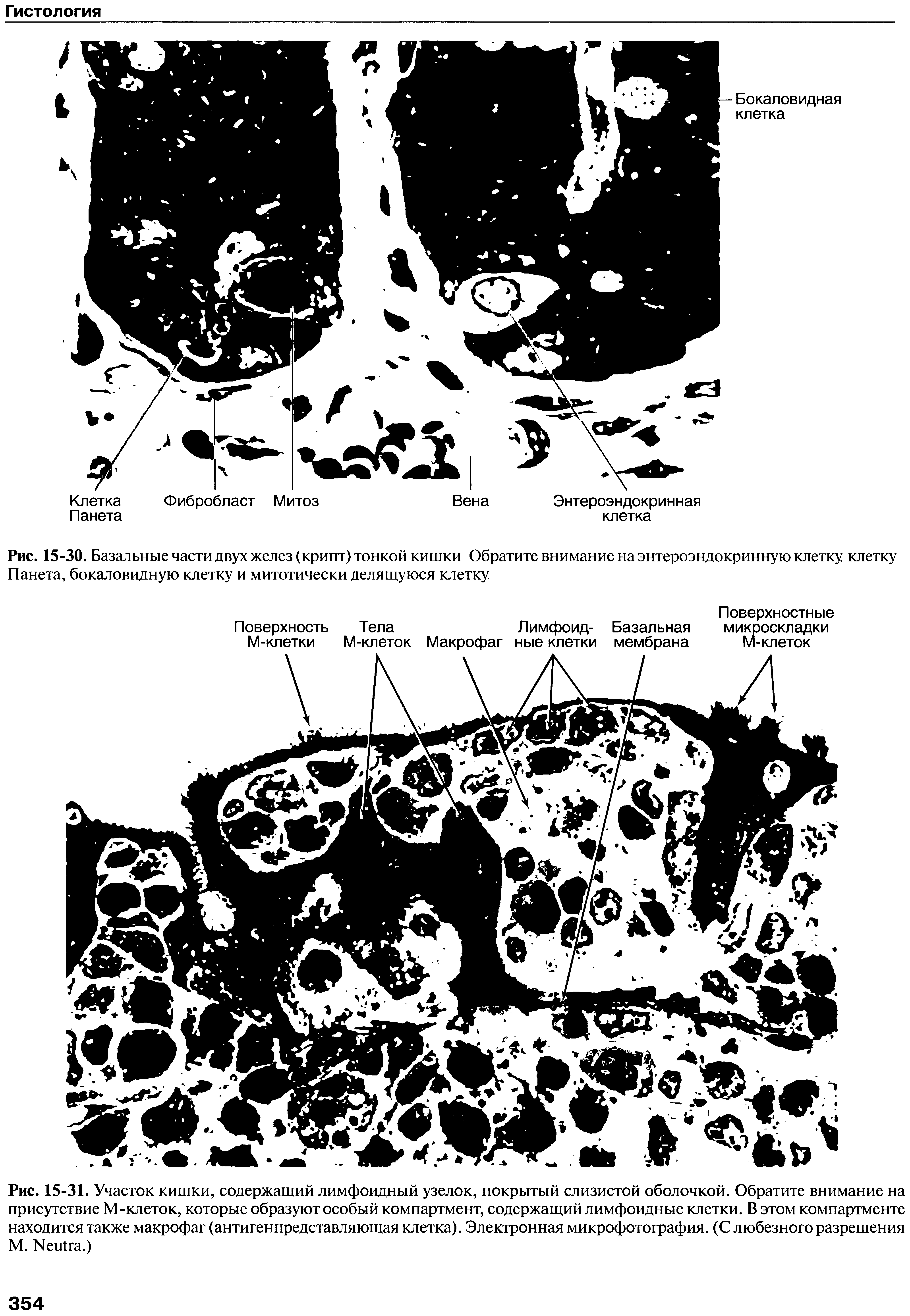 Рис. 15-31. Участок кишки, содержащий лимфоидный узелок, покрытый слизистой оболочкой. Обратите внимание на присутствие М-клеток, которые образуют особый компартмент, содержащий лимфоидные клетки. В этом компартменте находится также макрофаг (антигенпредставляющая клетка). Электронная микрофотография. (С любезного разрешения М. N .)...