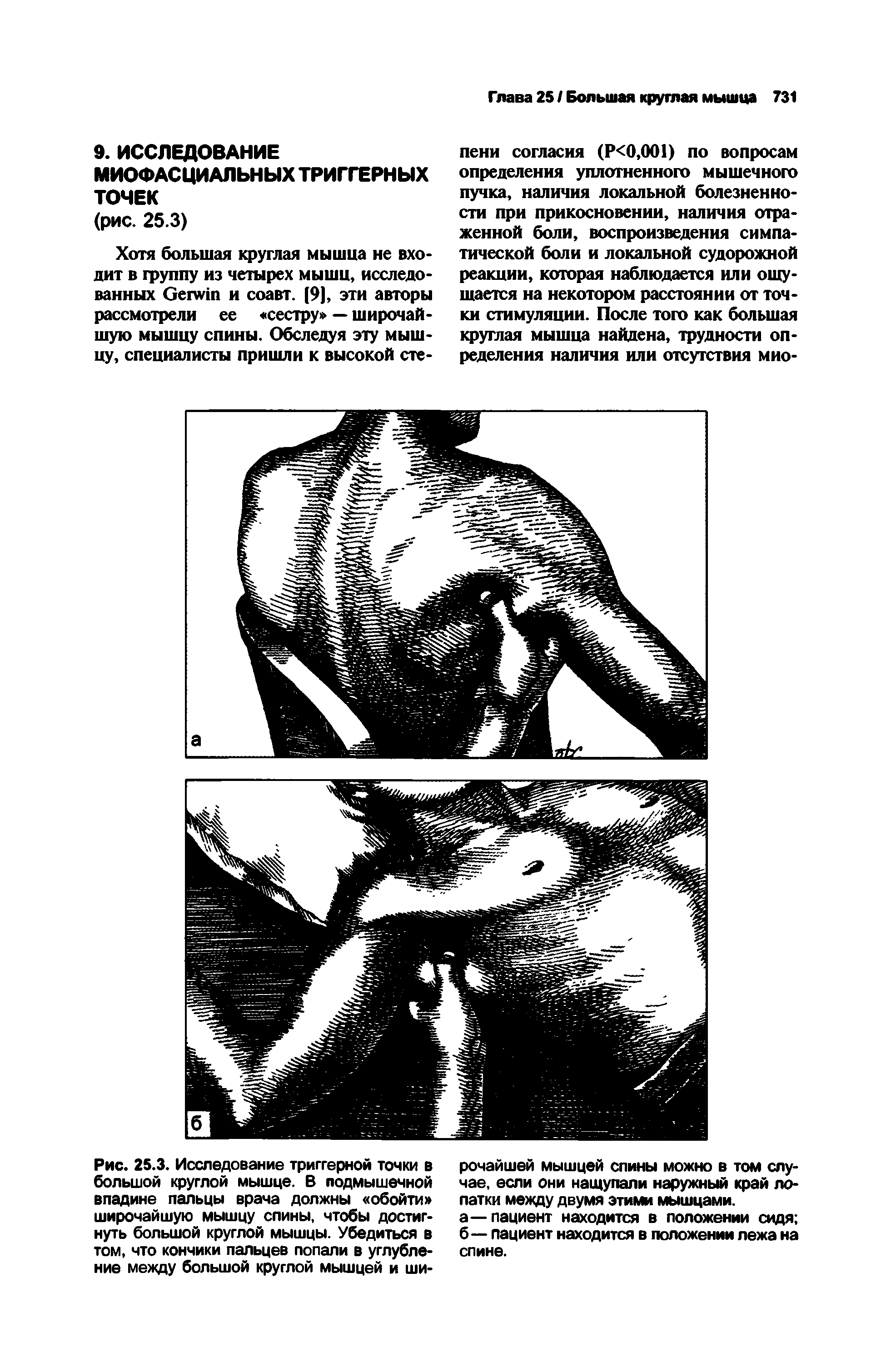 Рис. 25.3. Исследование триггерной точки в большой круглой мышце. В подмышечной впадине пальцы врача должны обойти широчайшую мышцу спины, чтобы достигнуть большой круглой мышцы. Убедиться в том, что кончики пальцев попали в углубление между большой круглой мышцей и ши-...