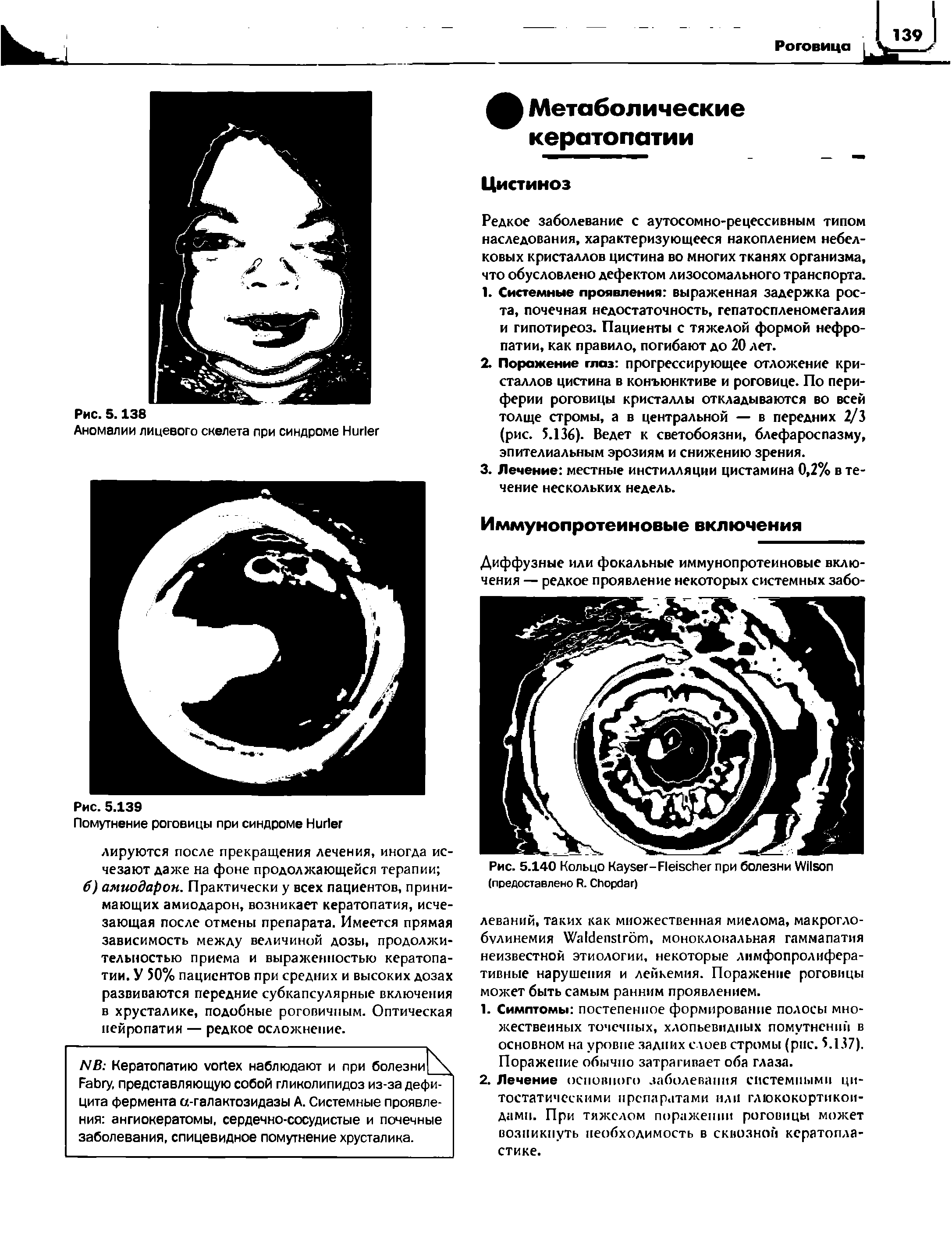 Рис. 5.140 Кольцо K -F при болезни W (предоставлено R. C )...