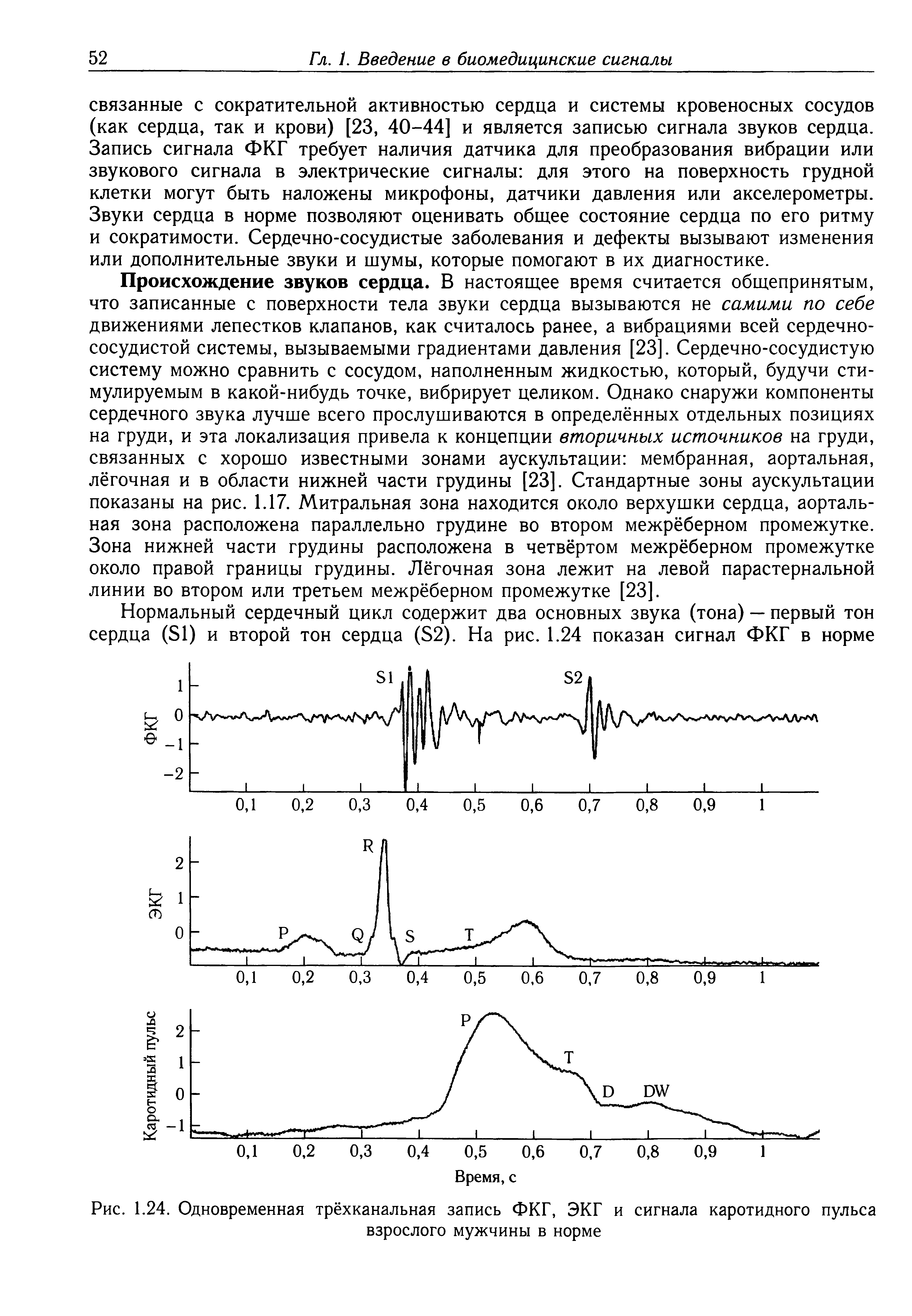 Рис. 1.24. Одновременная трёхканальная запись ФКГ, ЭКГ и сигнала каротидного пульса взрослого мужчины в норме...