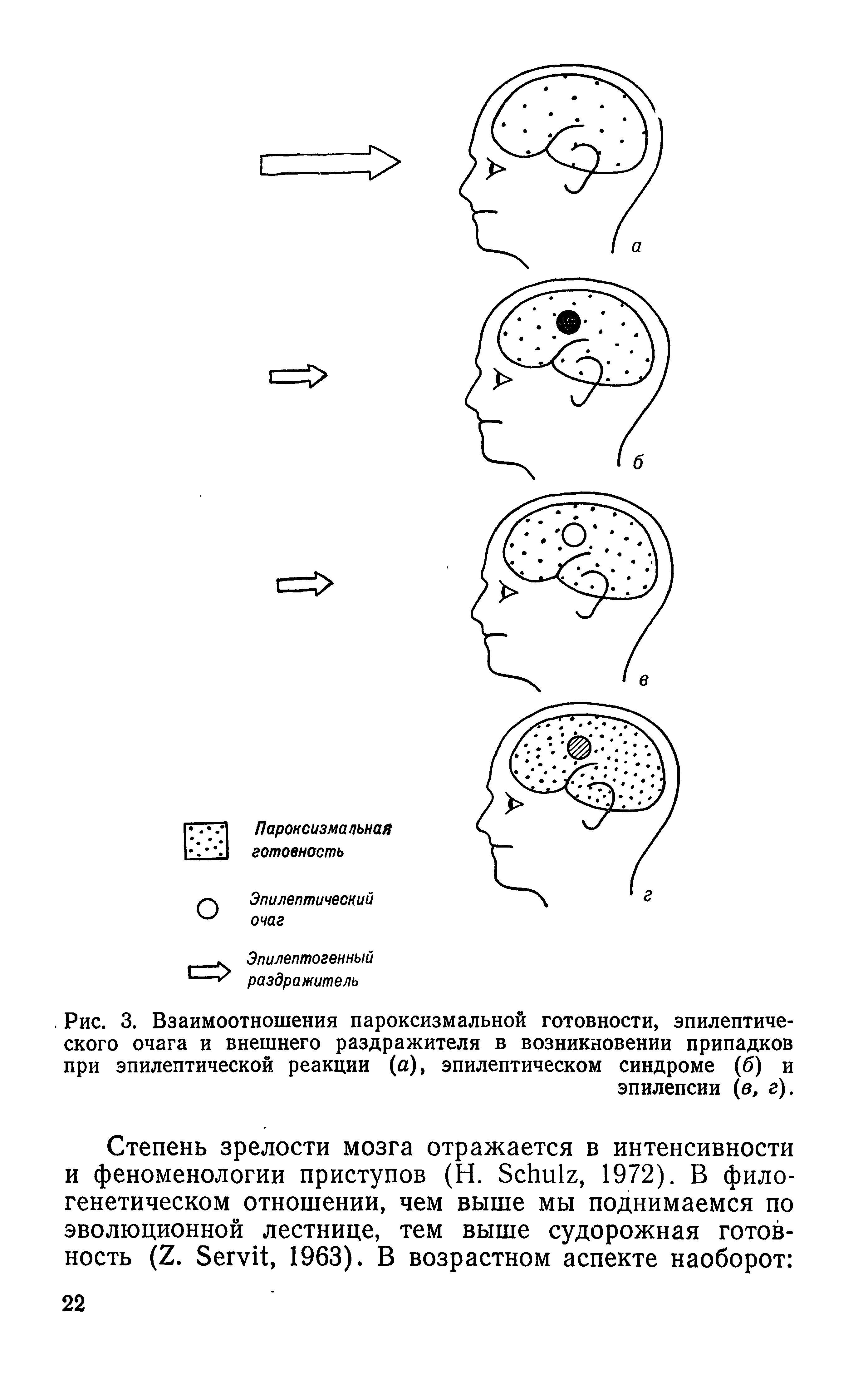 Рис. 3. Взаимоотношения пароксизмальной готовности, эпилептического очага и внешнего раздражителя в возникновении припадков при эпилептической реакции (а), эпилептическом синдроме (б) и эпилепсии (в, г).