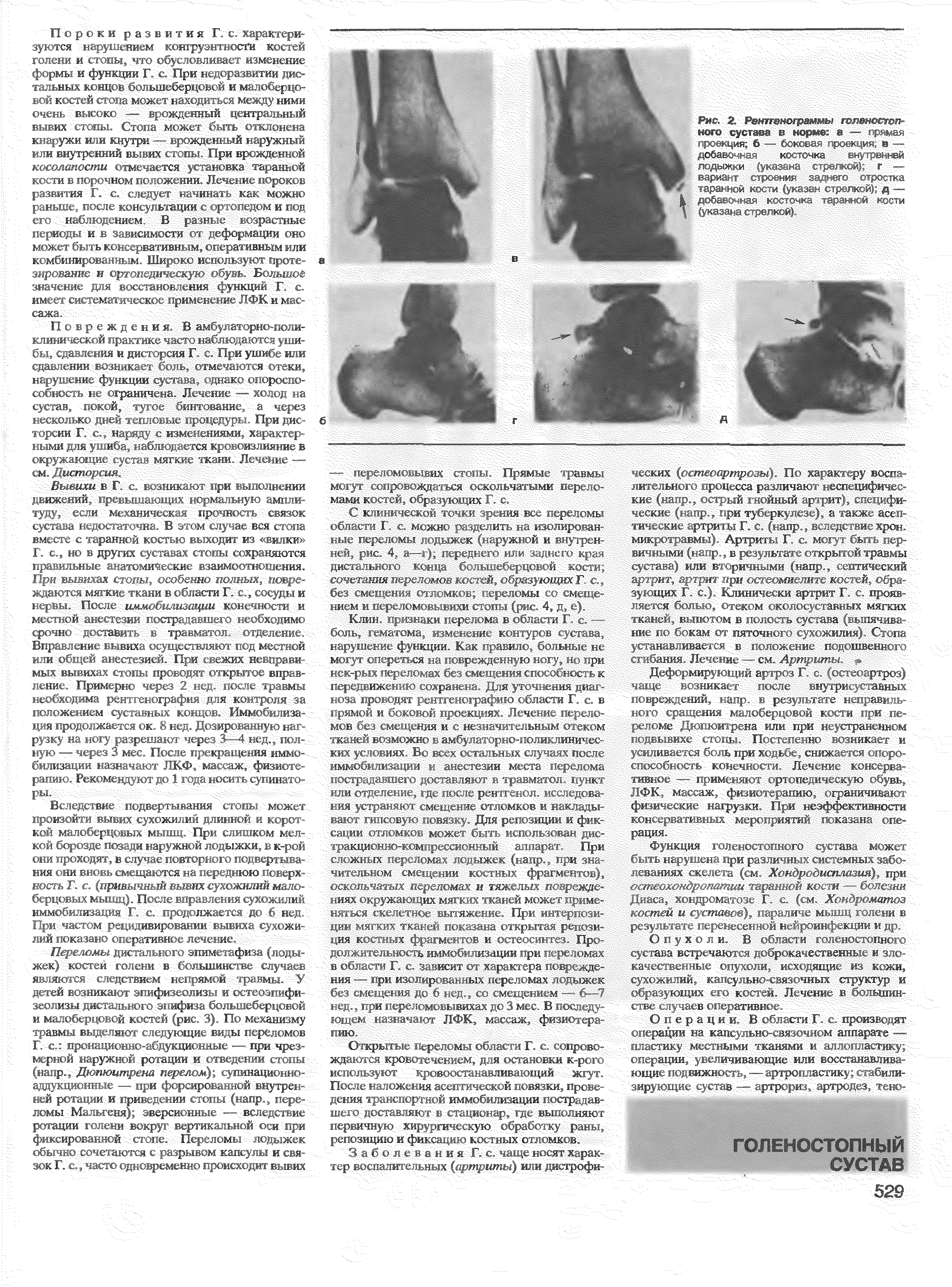 Рис. 2. Рентгенограммы голеностопного сустава в норме а — сусь-ш, истжция. 6 — LT - "(р АИ в — добаыст -L K CTHK ал. ц.С-Ы ВЙ Ж РСДЫЖ И I к. ш, M Г —...