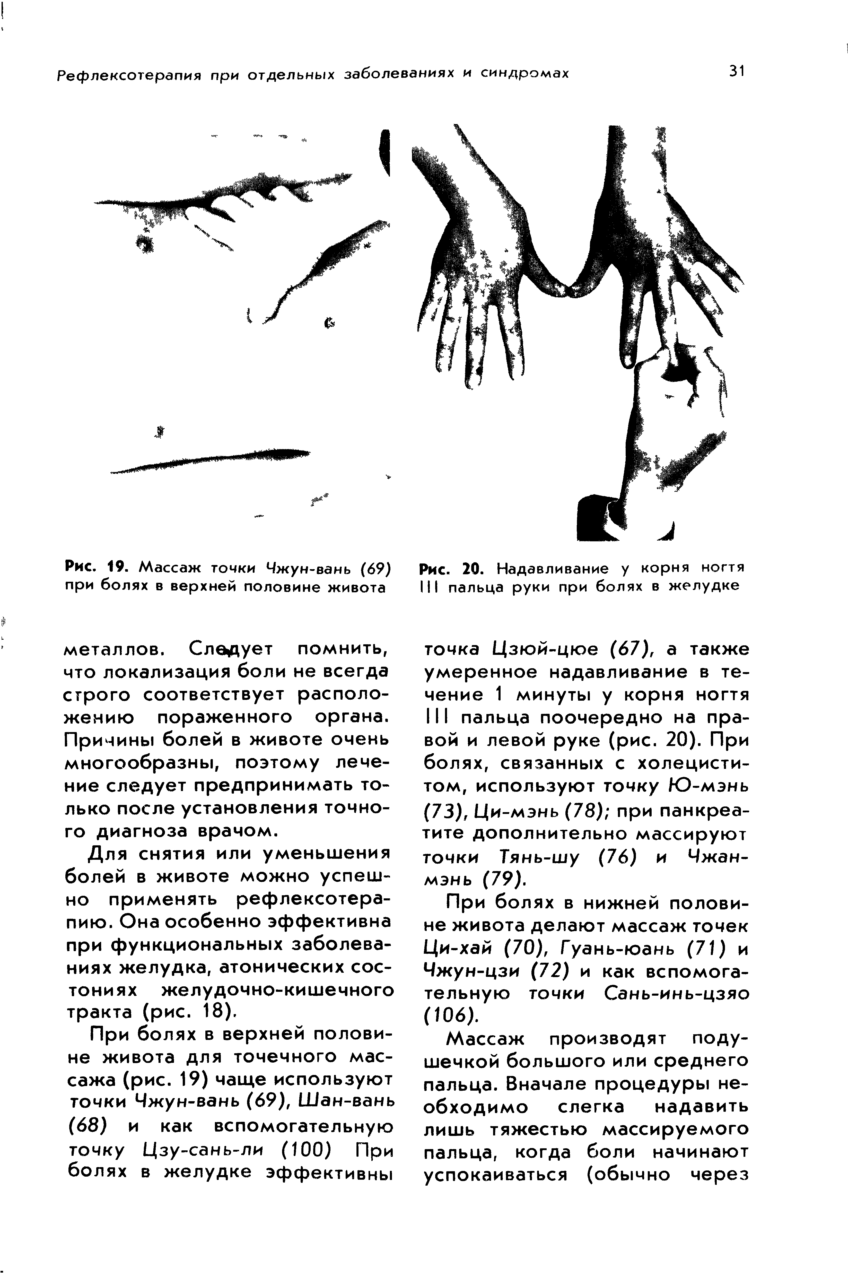 Рис. 19. Массаж точки Чжун-вань (69) при болях в верхней половине живота...