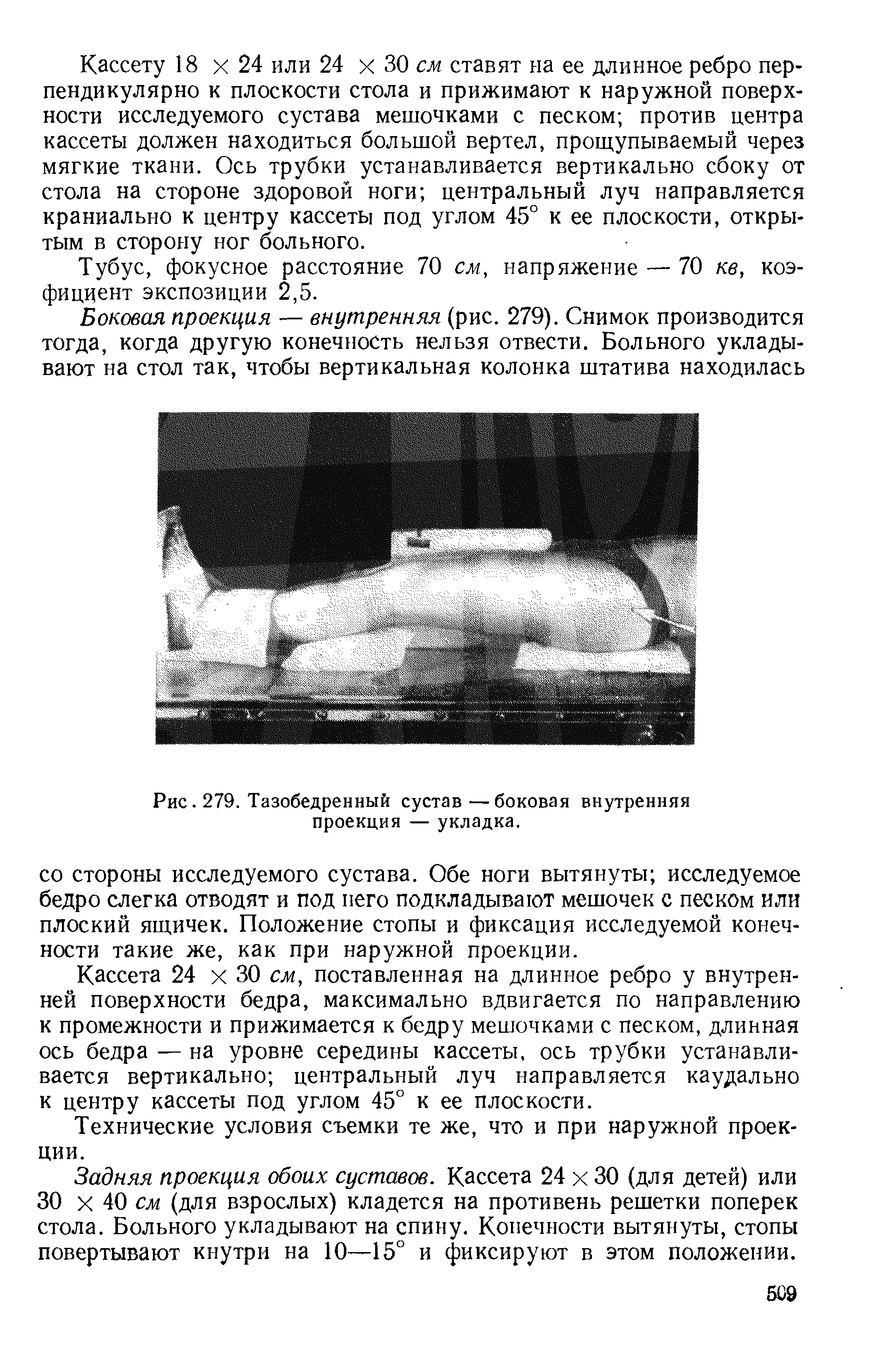 Рис. 279. Тазобедренный сустав—боковая внутренняя проекция — укладка.