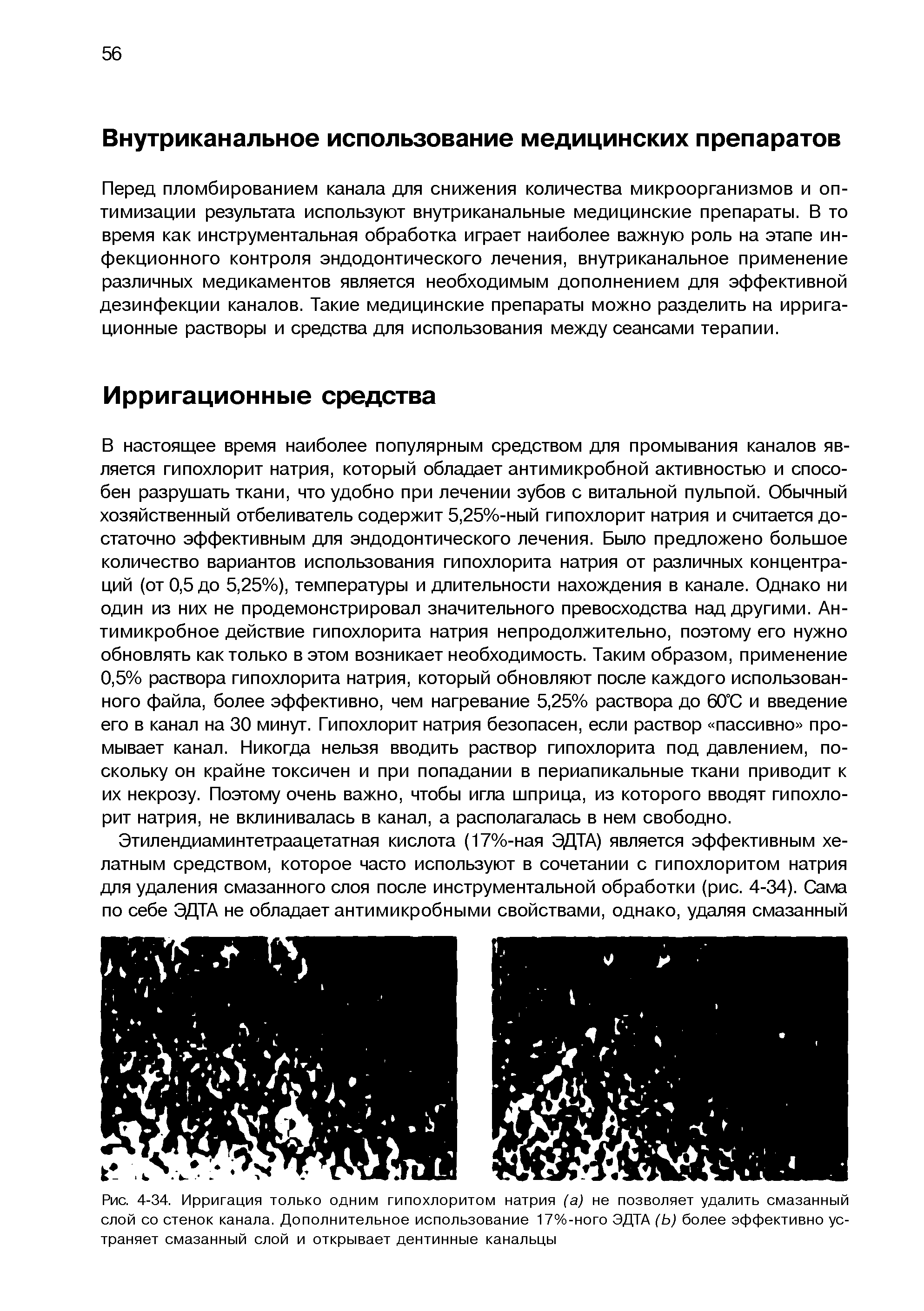 Рис. 4-34. Ирригация только одним гипохлоритом натрия (а) не позволяет удалить смазанный слой со стенок канала. Дополнительное использование 17%-ного ЭДТА (Ь) более эффективно устраняет смазанный слой и открывает дентинные канальцы...