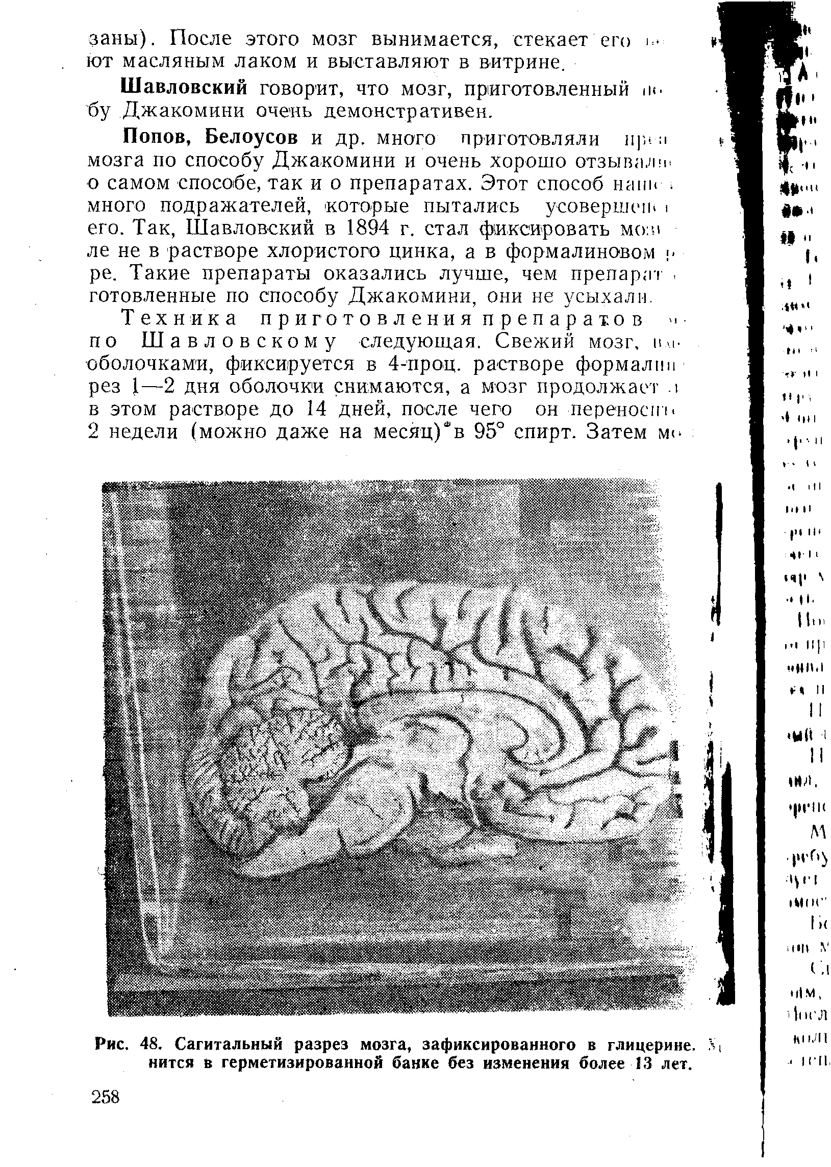 Рис. 48. Сагитальный разрез мозга, зафиксированного в глицерине, нится в герметизированной банке без изменения более 13 лет.