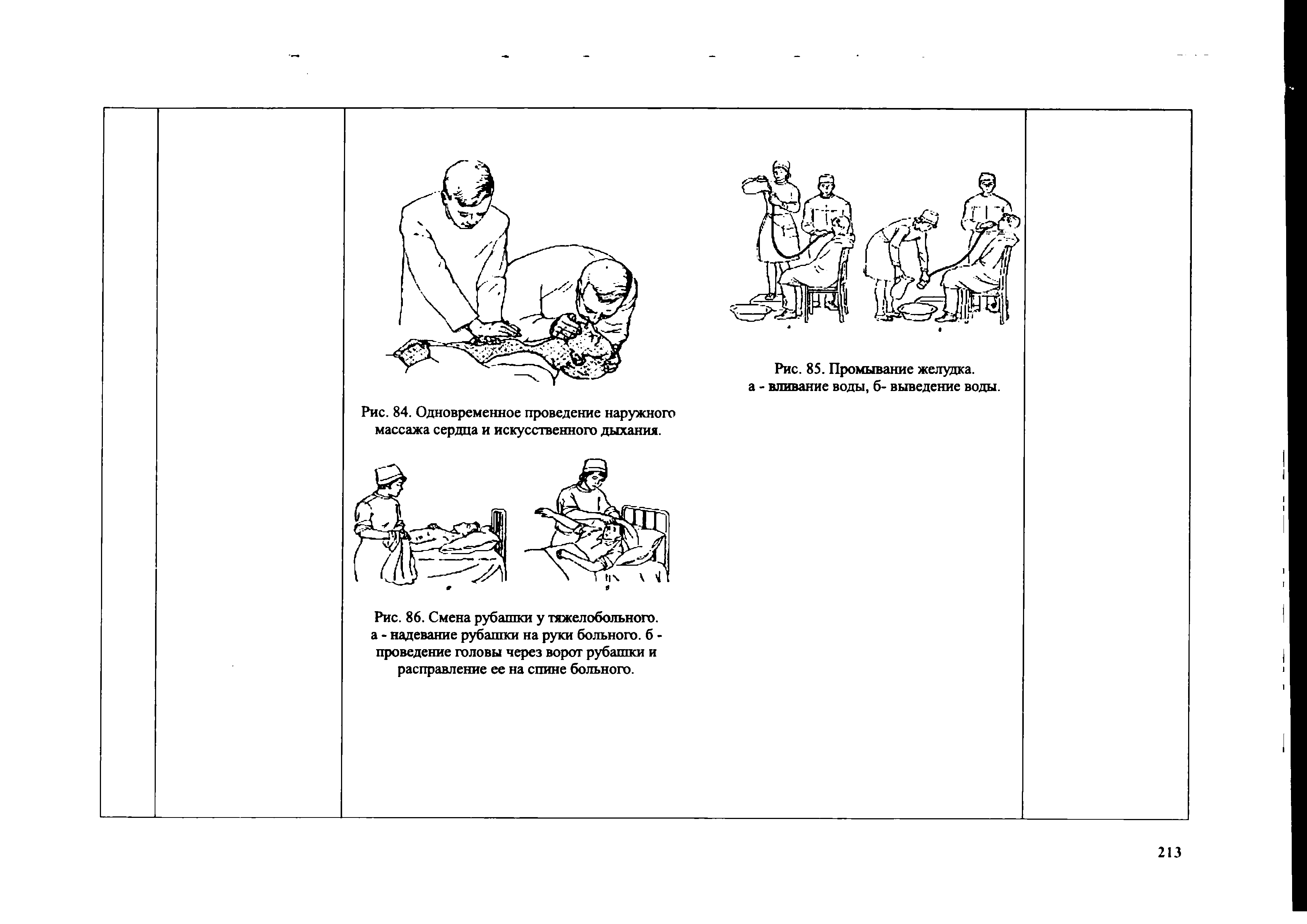 Рис. 86. Смена рубашки у тяжелобольного, а - надевание рубашки на руки больного, б -проведение головы через ворот рубашки и расправление ее на спине больного.