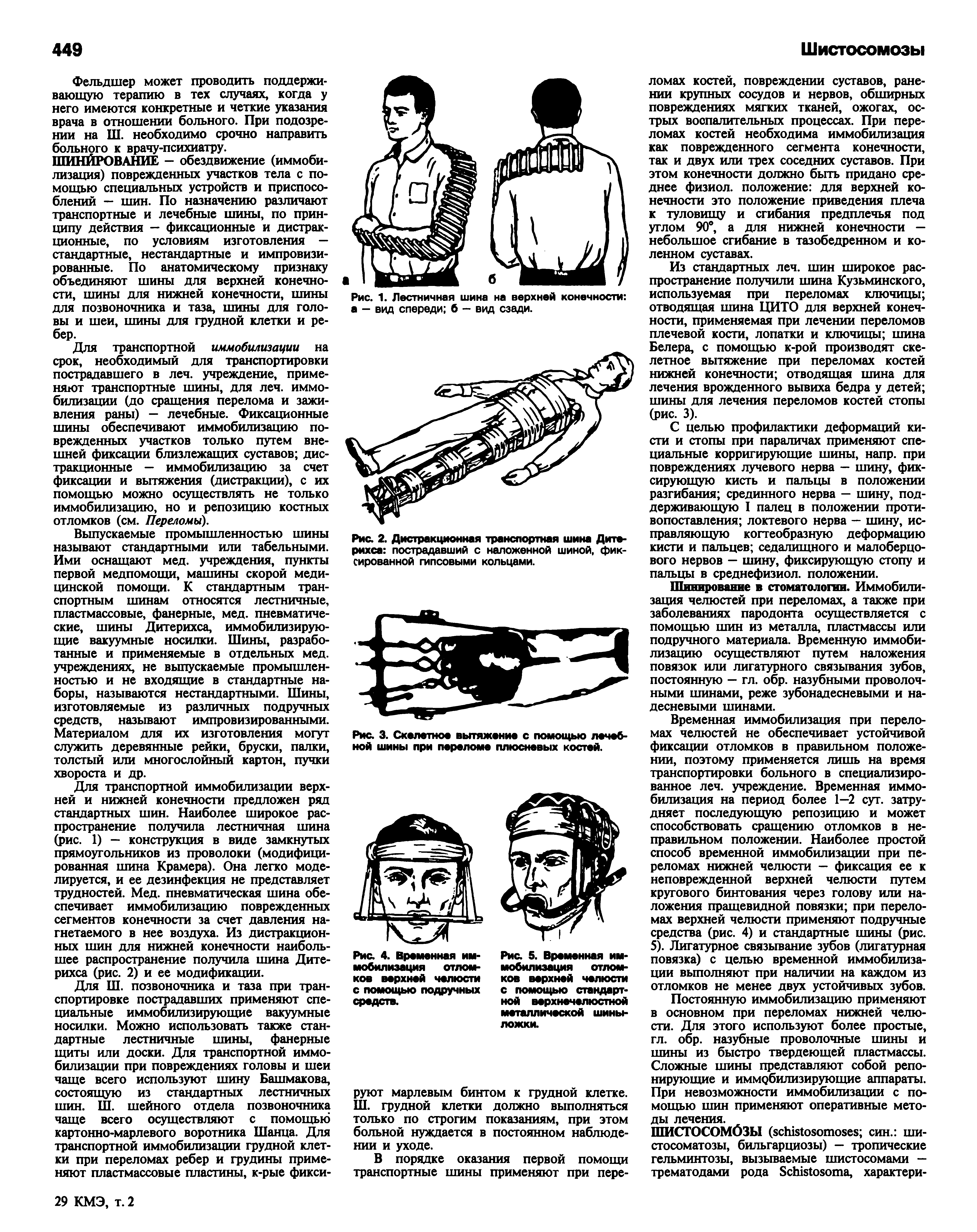 Рис. 2. Дистракционная транспортная шина Дитерихса пострадавший с наложенной шиной, фиксированной гипсовыми кольцами.