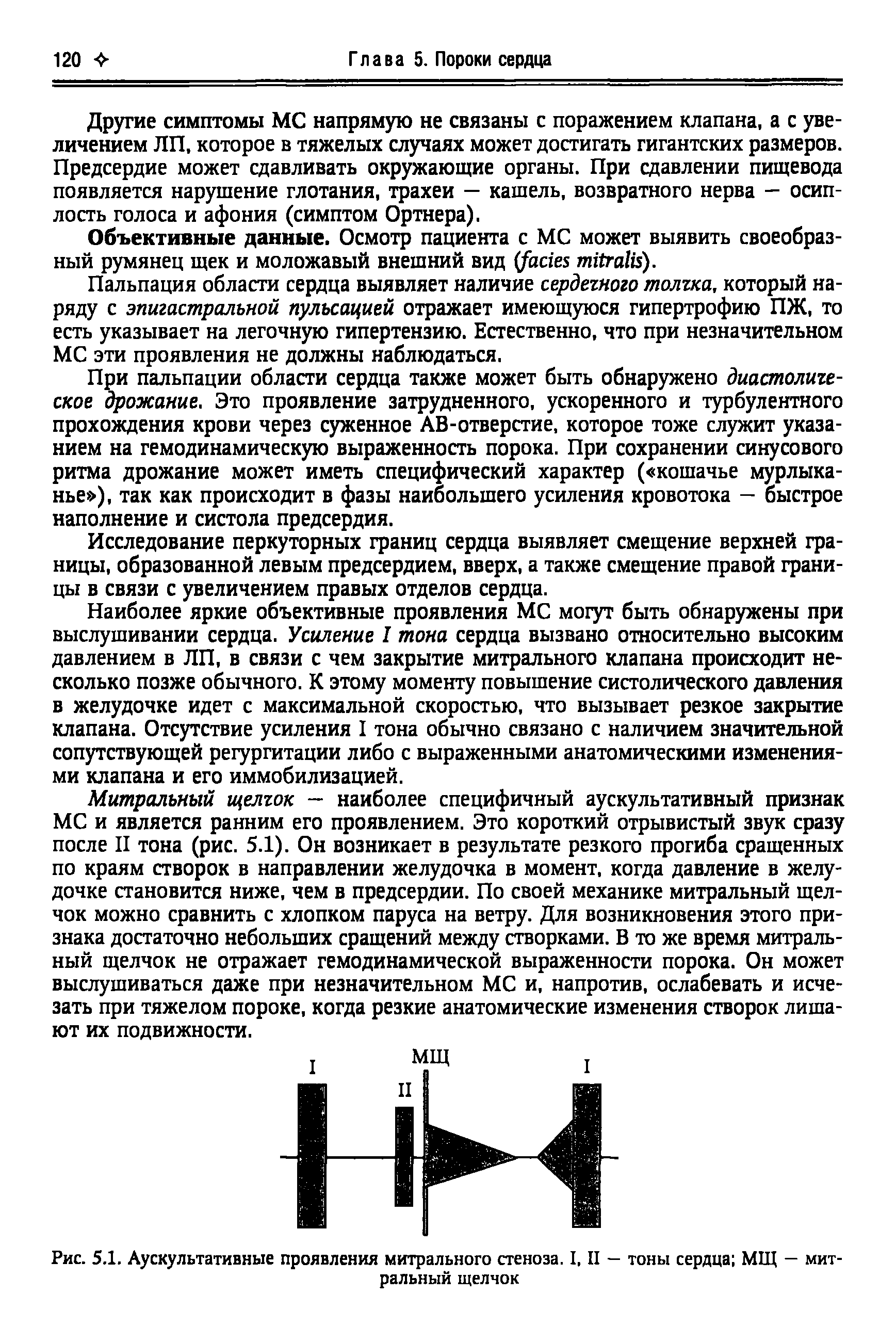 Рис. 5.1. Аускультативные проявления митрального стеноза. I. II — тоны сердца МЩ — митральный щелчок...