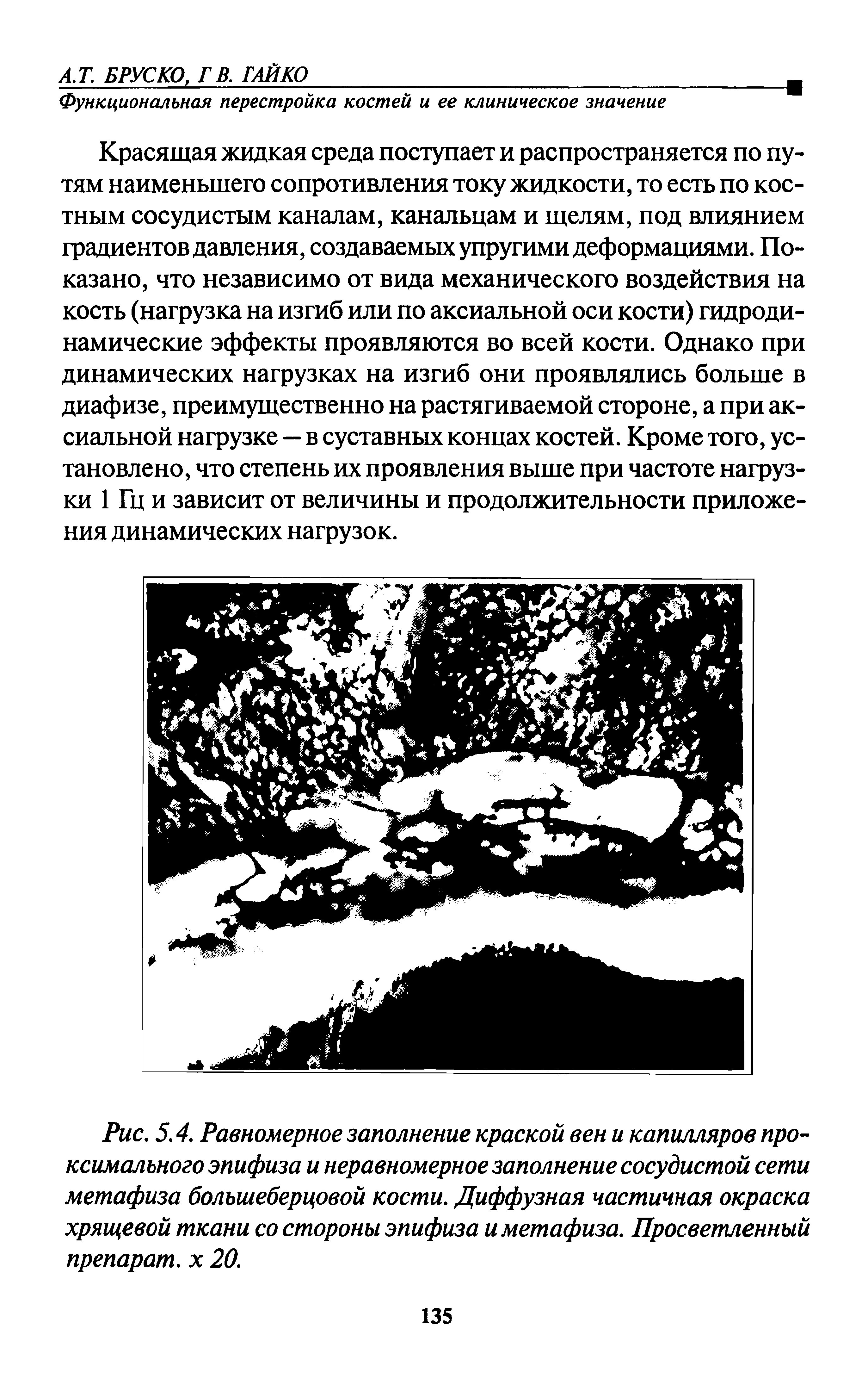 Рис. 5.4. Равномерное заполнение краской вен и капилляров проксимального эпифиза и неравномерное заполнение сосудистой сети метафиза большеберцовой кости. Диффузная частичная окраска хрящевой ткани со стороны эпифиза и метафиза. Просветленный препарат, х 20.