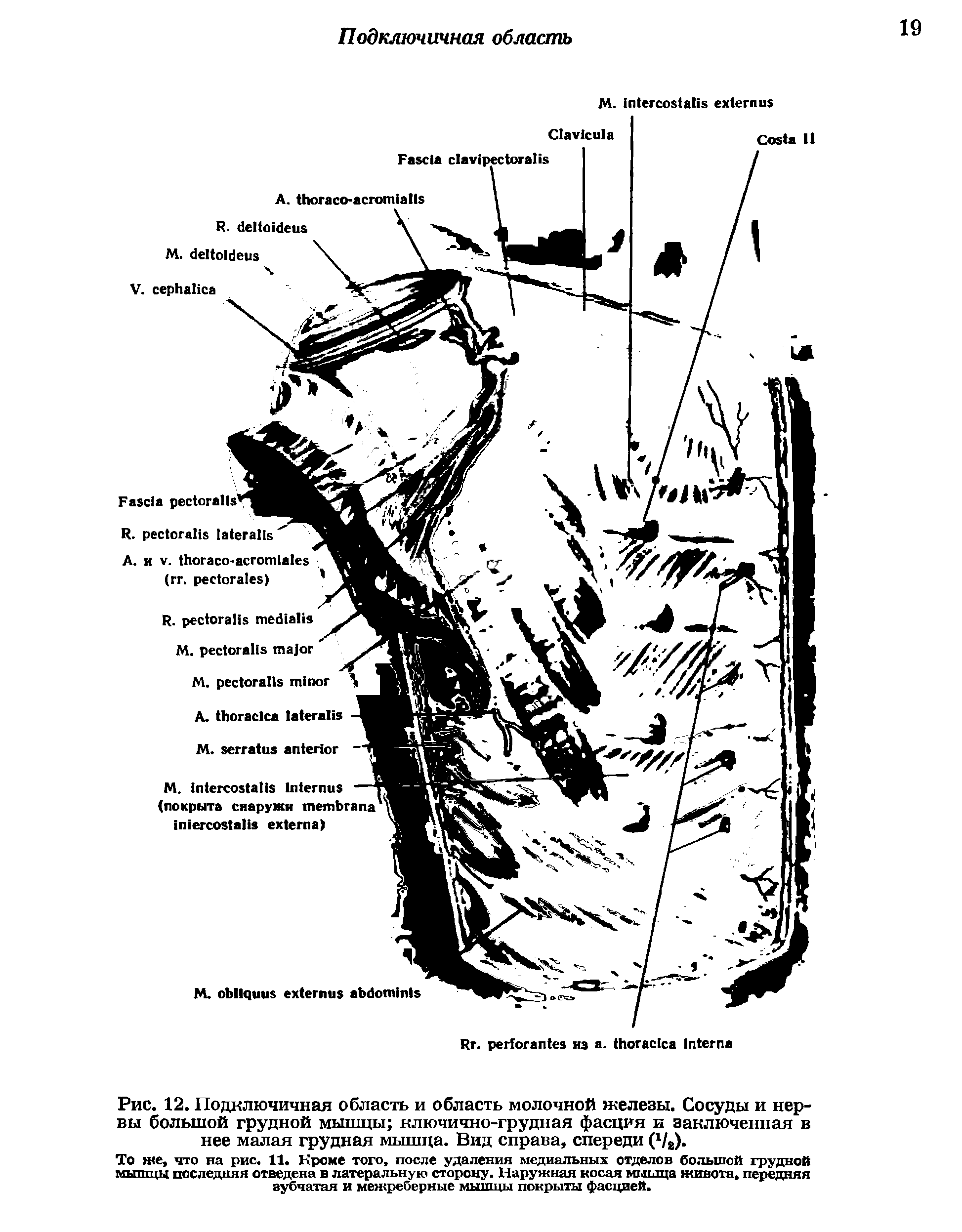 Рис. 12. Подключичная область и область молочной железы. Сосуды и нервы большой грудной мышцы ключично-грудная фасция и заключенная в нее малая грудная мышца. Вид справа, спереди (1/а).