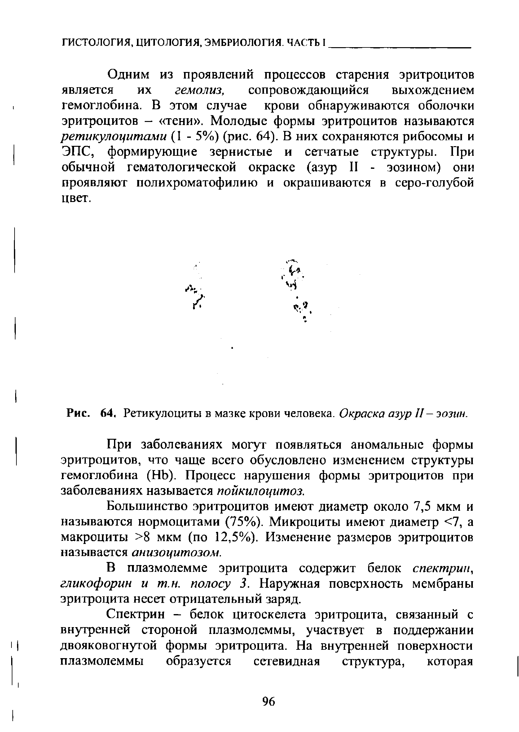 Рис. 64. Ретикулоциты в мазке крови человека. Окраска азур II- эозин.