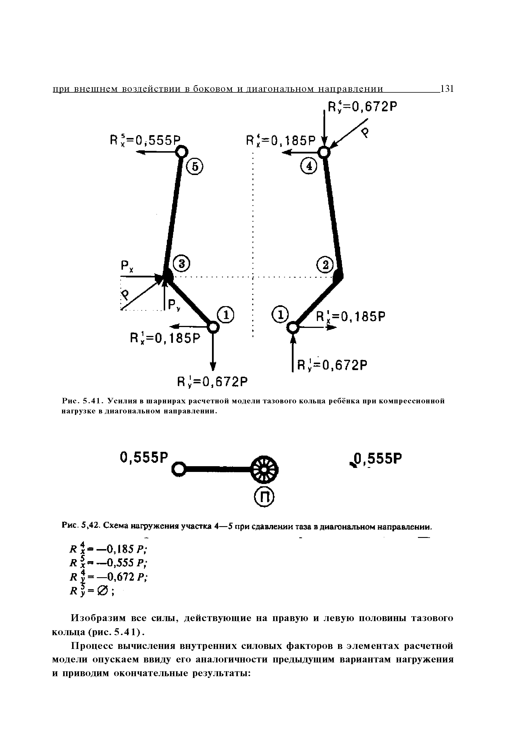 Рис. 5,42. Схема нагружения участка 4—5 при сдавлении таза в диагональном направлении.