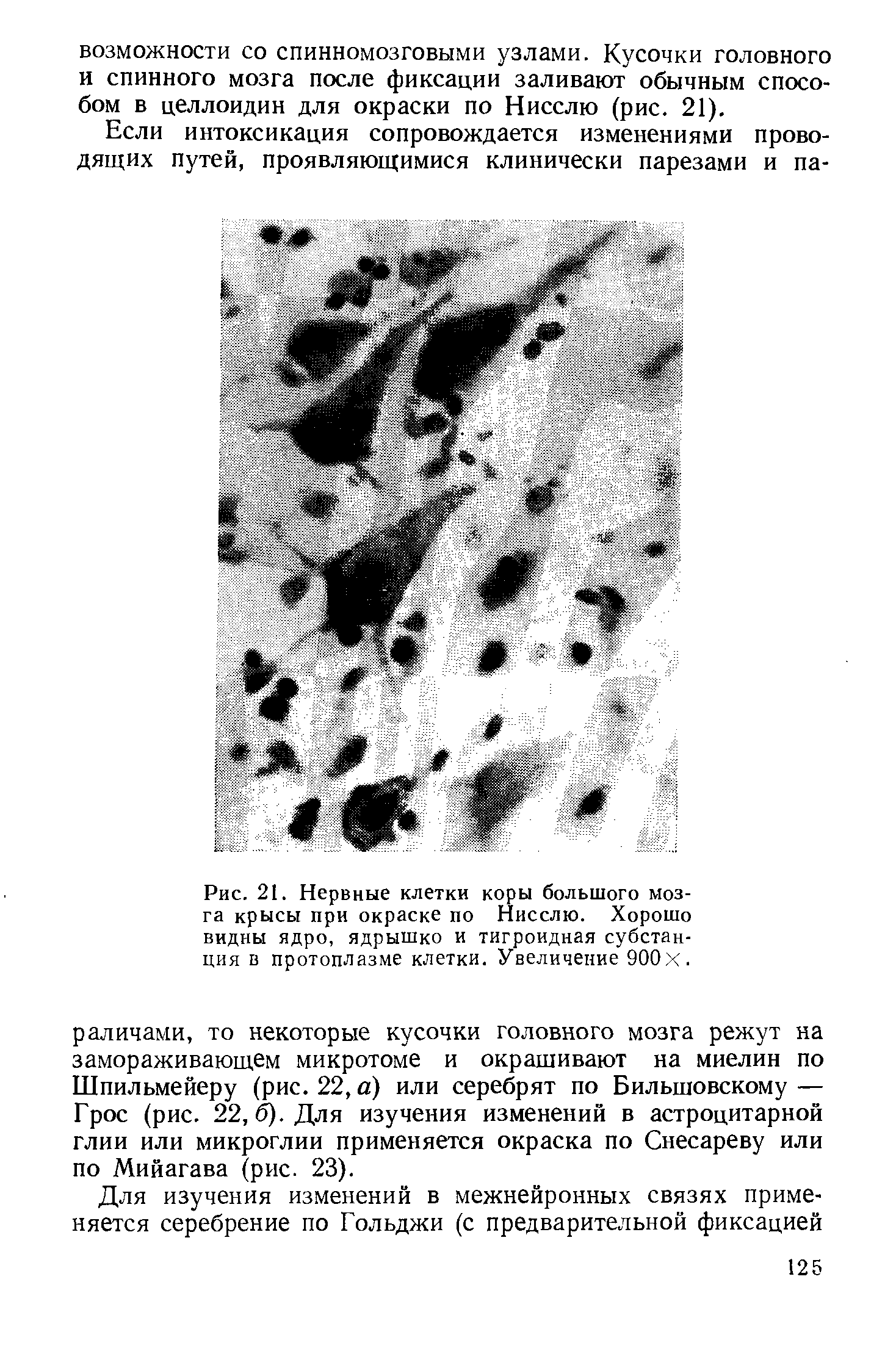 Рис. 21. Нервные клетки коры большого мозга крысы при окраске по Нисслю. Хорошо видны ядро, ядрышко и тигроидная субстанция в протоплазме клетки. Увеличение 900X.