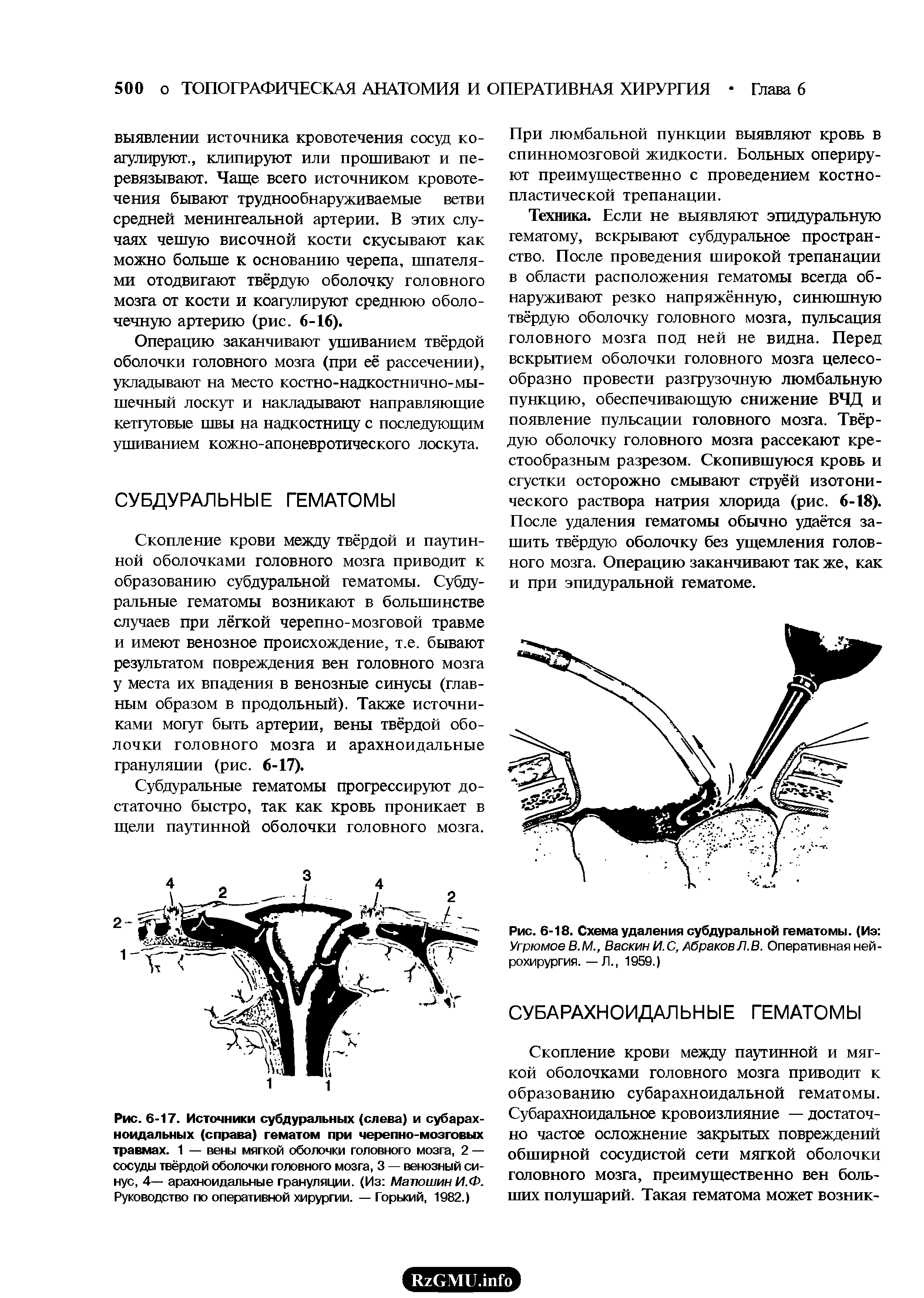 Рис. 6-17. Источники субдуральных (слева) и субарахноидальных (справа) гематом при черепно-мозговых травмах. 1 — вены мягкой оболочки головного мозга, 2 — сосуды твёрдой оболочки головного мозга, 3 — венозный синус, 4— арахноидальные грануляции. (Из Матюшин И.Ф. Руководство по оперативной хирургии. — Горький, 1982.)...