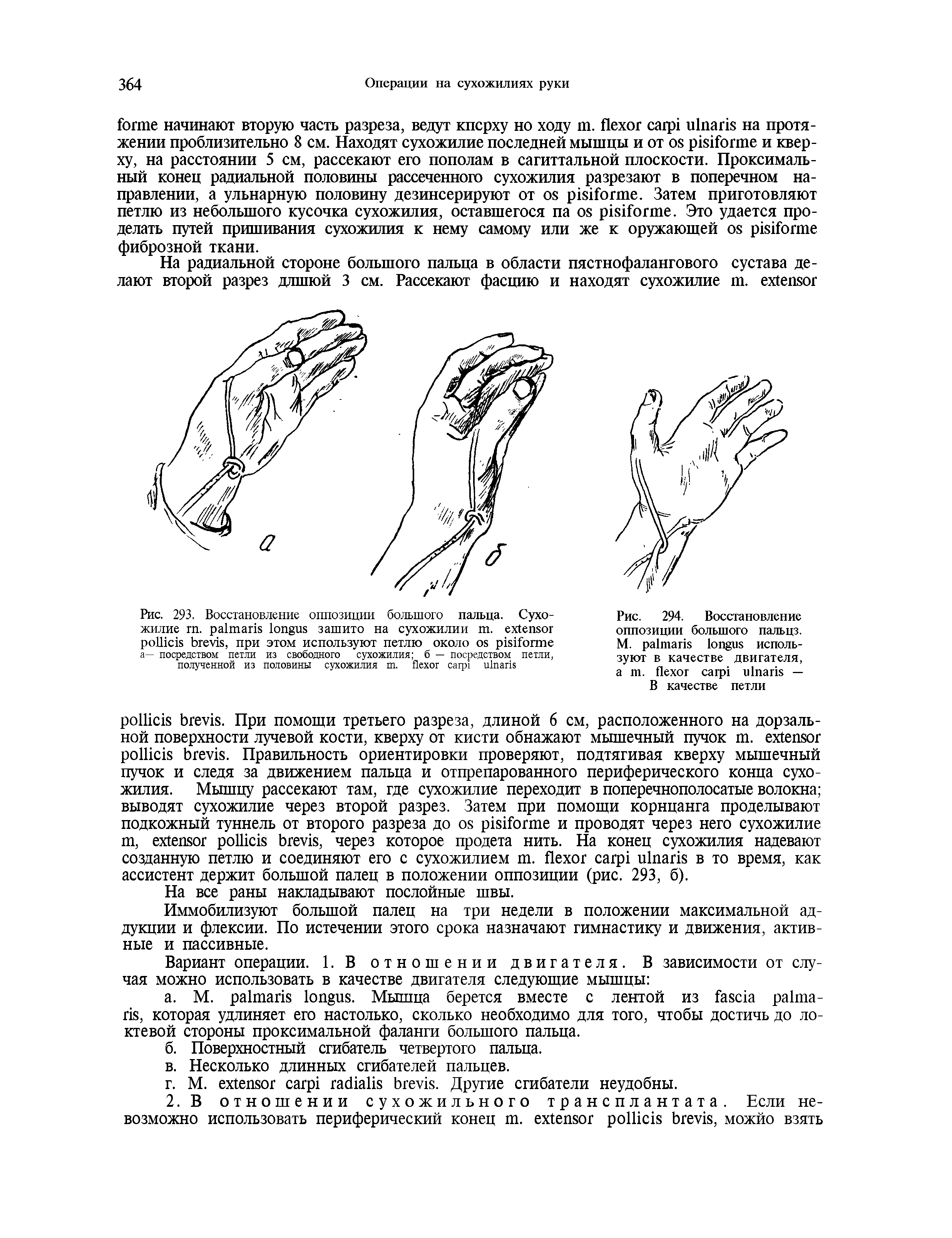 Рис. 294. Восстановление оппозиции большого пальцз. М. используют в качестве двигателя, . — В качестве петли...