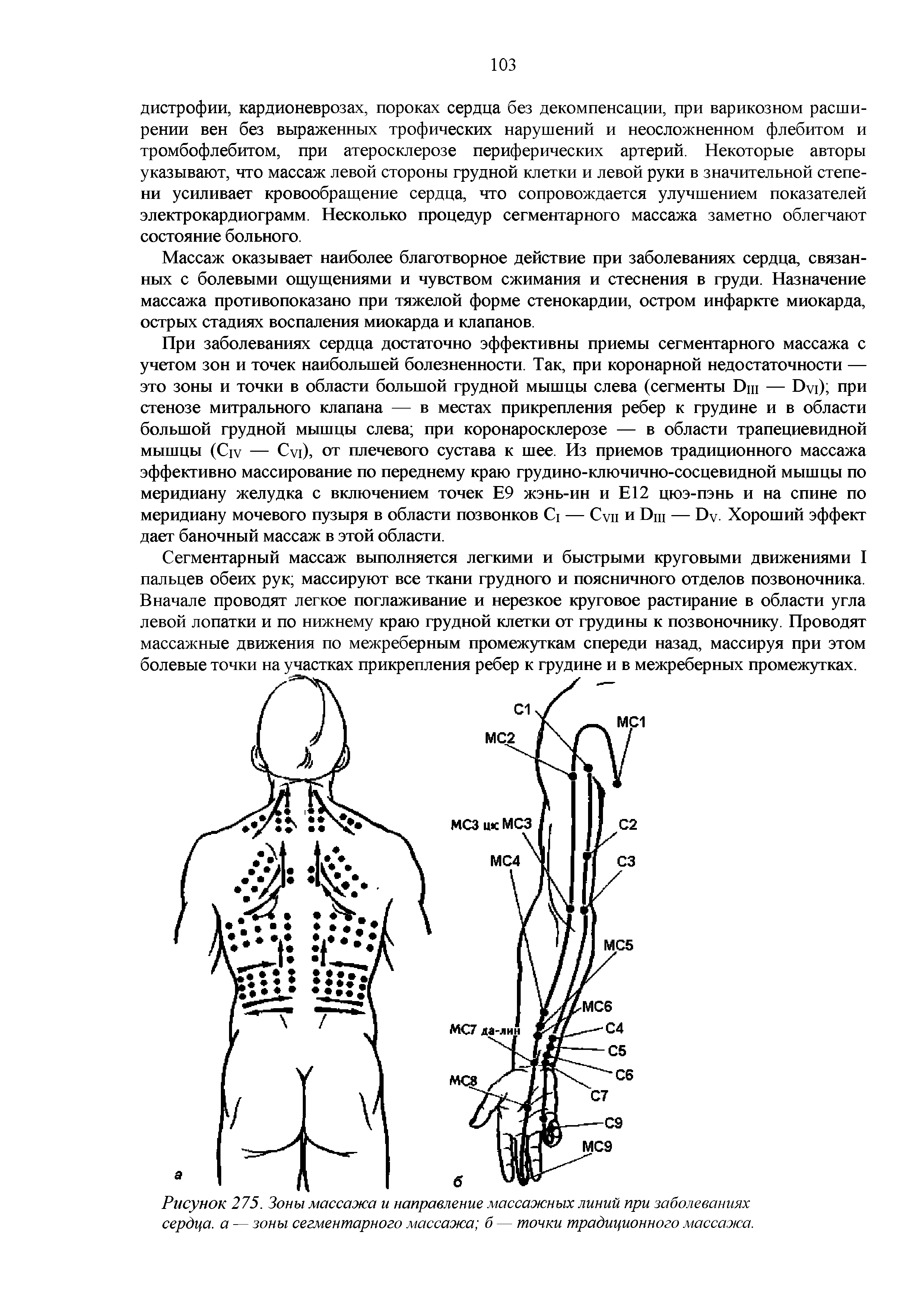 Рисунок 275. Зоны массажа и направление массажных линий при заболеваниях сердца, а — зоны сегментарного массажа б — точки традиционного массажа.