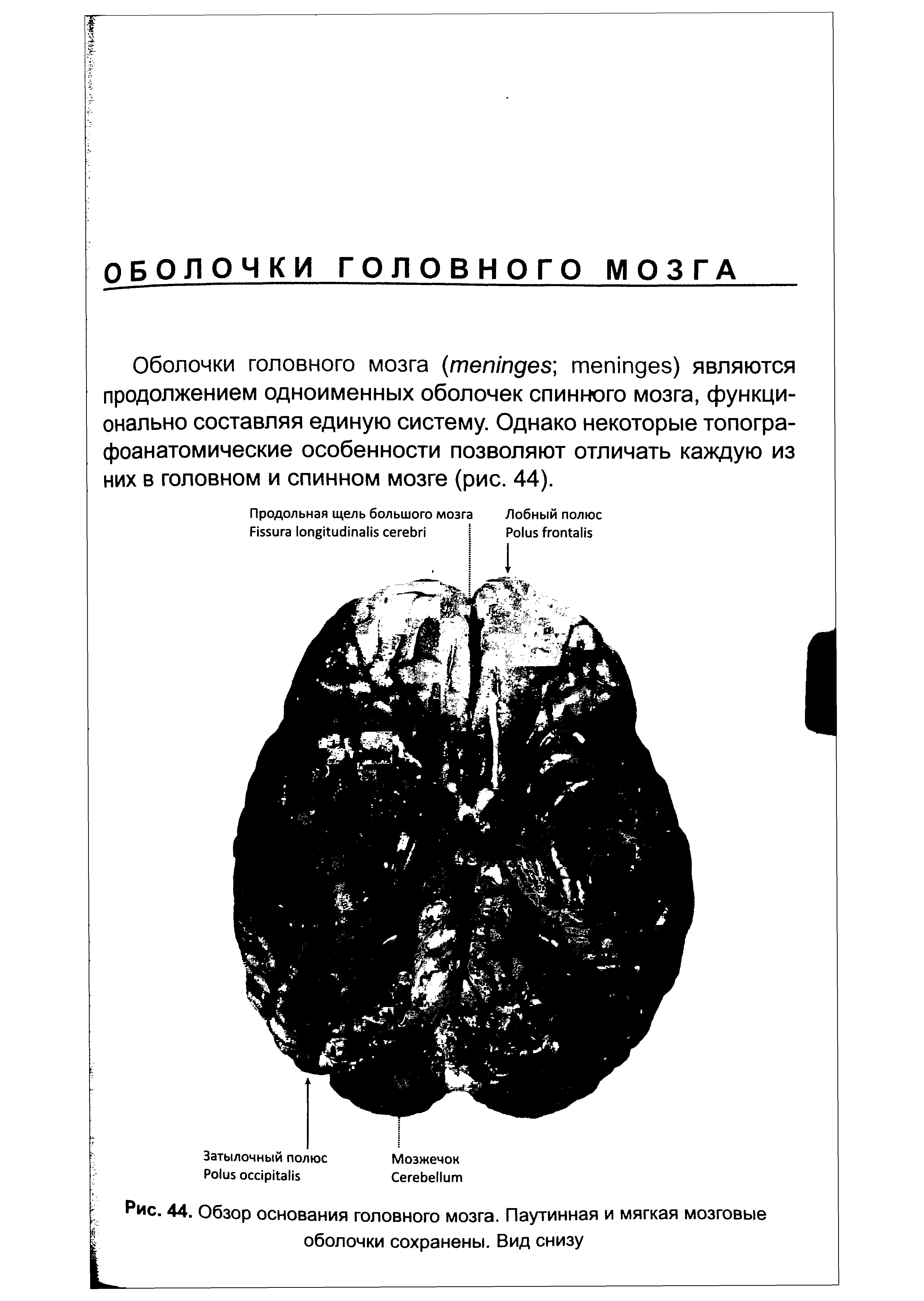 Рис. 44. Обзор основания головного мозга. Паутинная и мягкая мозговые оболочки сохранены. Вид снизу...