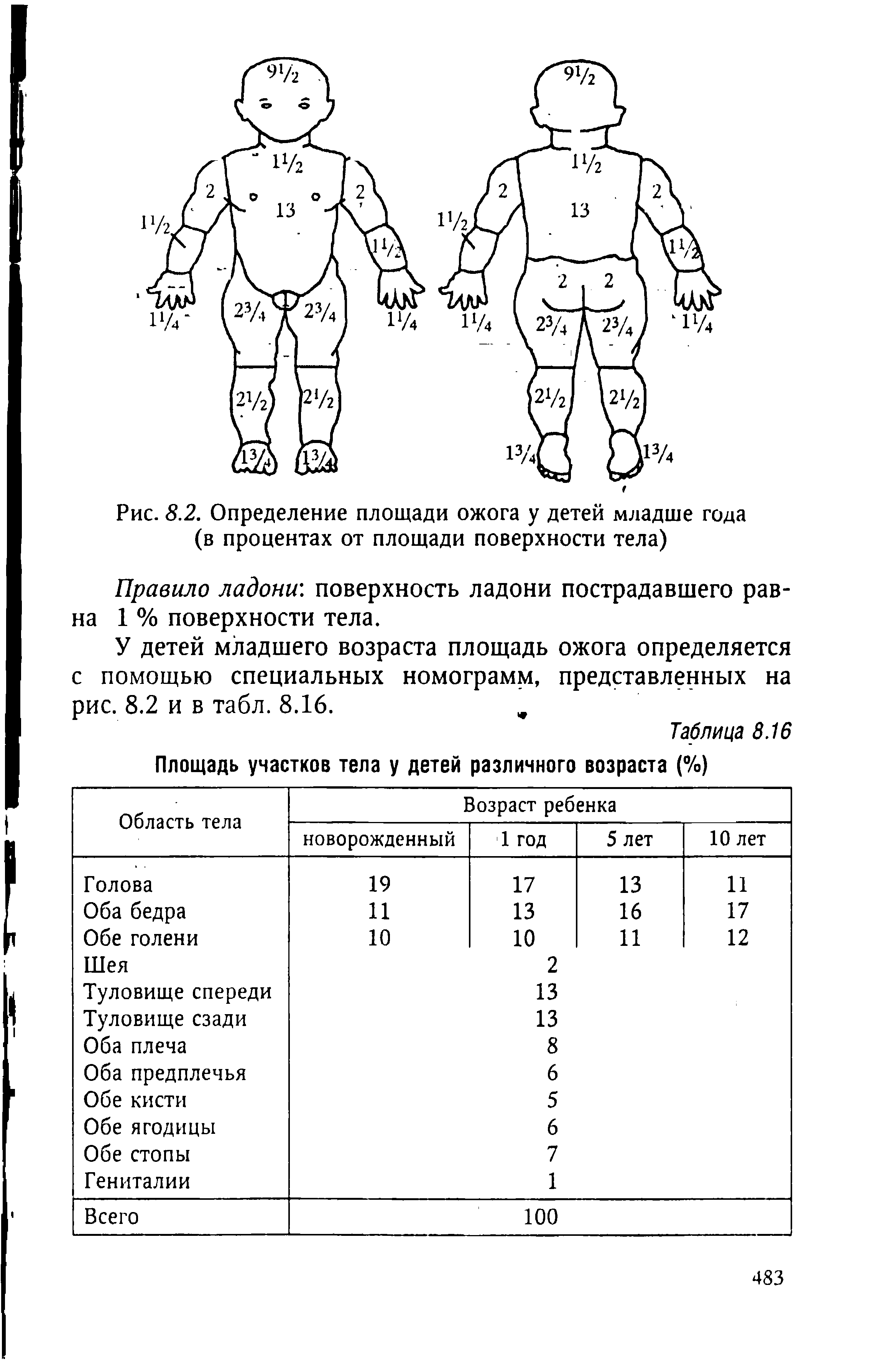 Рис. 8.2. Определение площади ожога у детей младше года (в процентах от площади поверхности тела)...