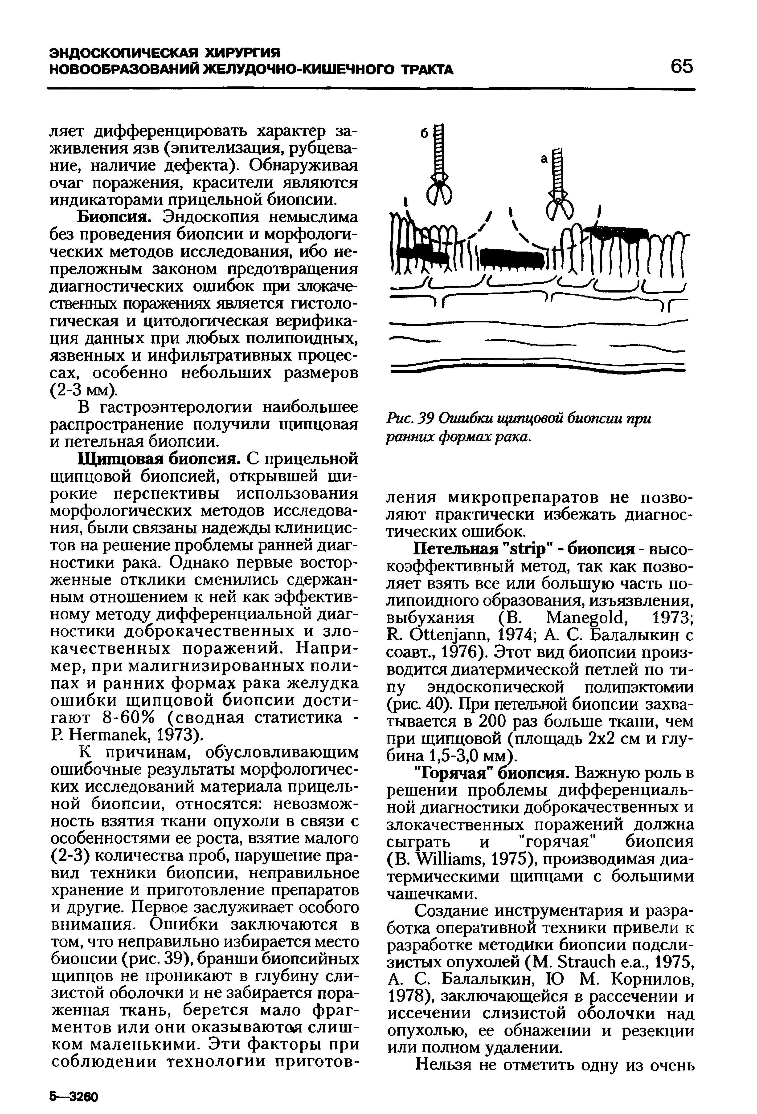 Рис. 39 Ошибки щипцовой биопсии при ранних формах рака.