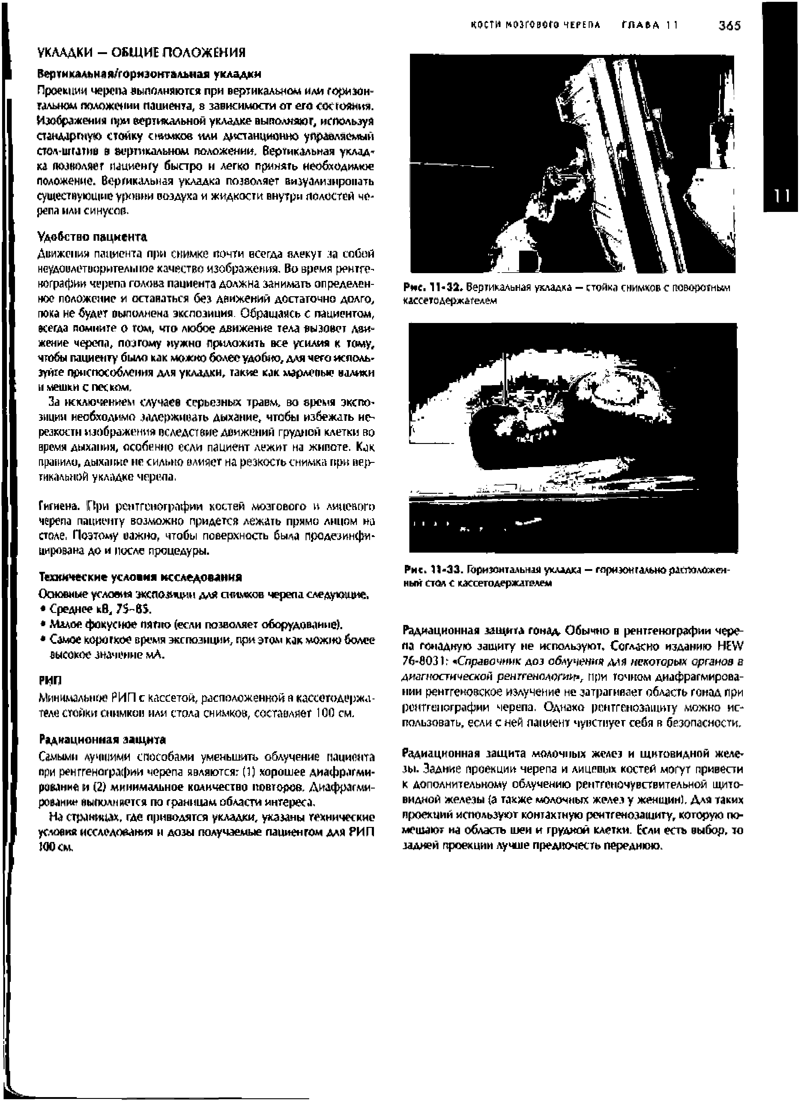 Рис. 11-31. Вертикальная укладка - стойка снимков с поворотньии кассетодержателем...