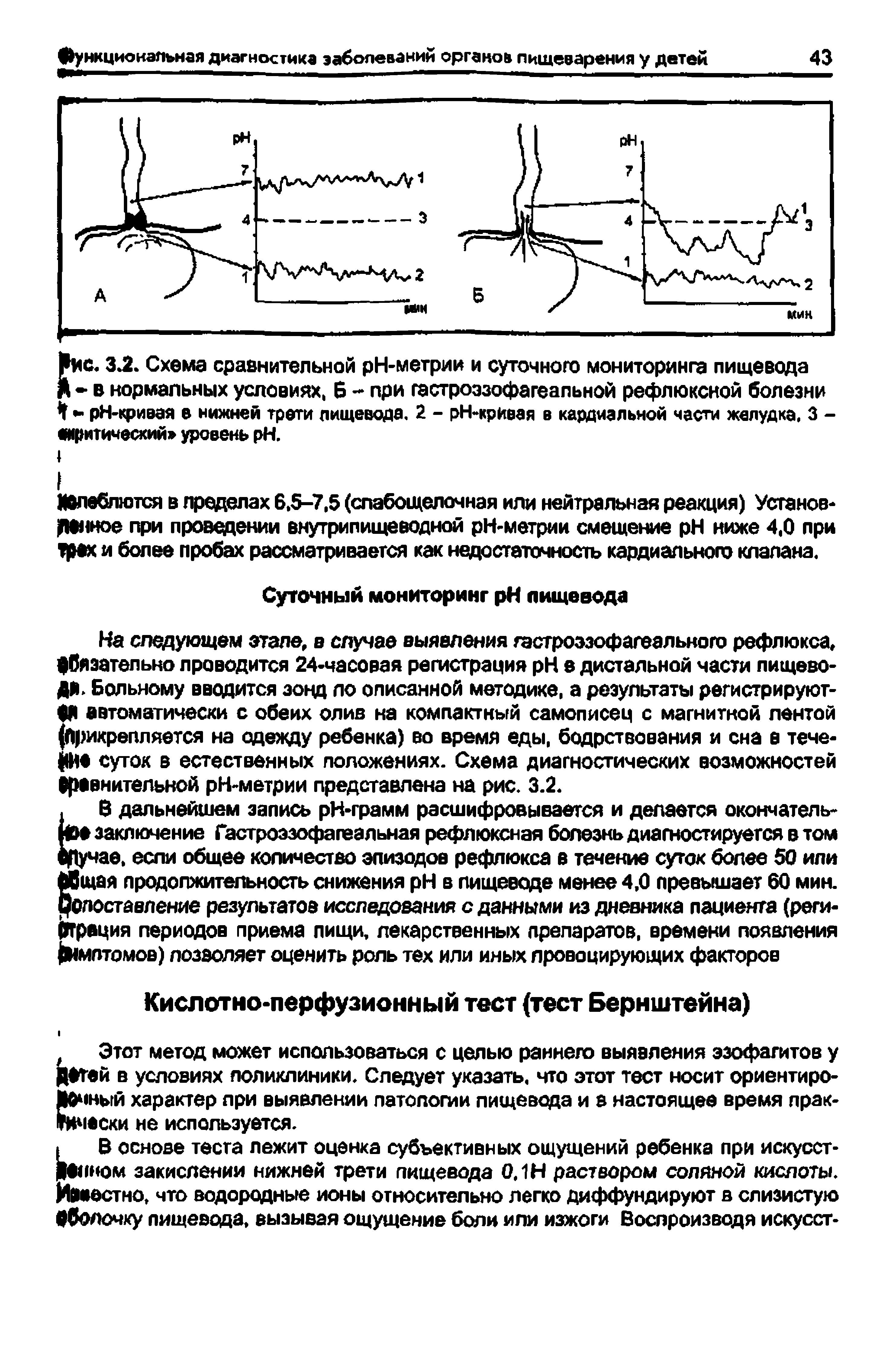 Рис. 3.2. Схема сравнительной рН-метрии и суточного мониторинга пищевода Я в нормальных условиях, 6 - при гастроэзофагеальной рефлюксной болезни I рН-криаая в нижней трети пищевода, 2 - рН-крИеая в кардиальной части желудка, 3 - критический уровень H.