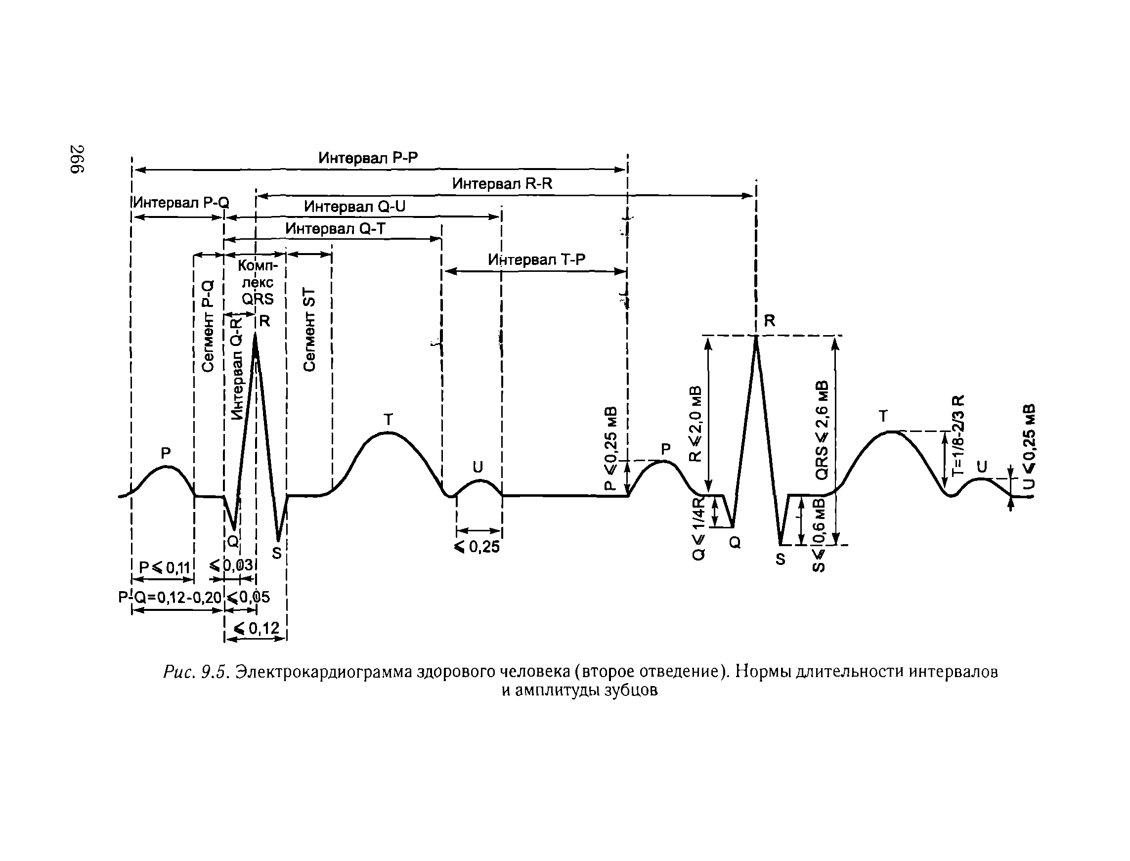 Рис. 9.5. Электрокардиограмма здорового человека (второе отведение). Нормы длительности интервалов и амплитуды зубцов...