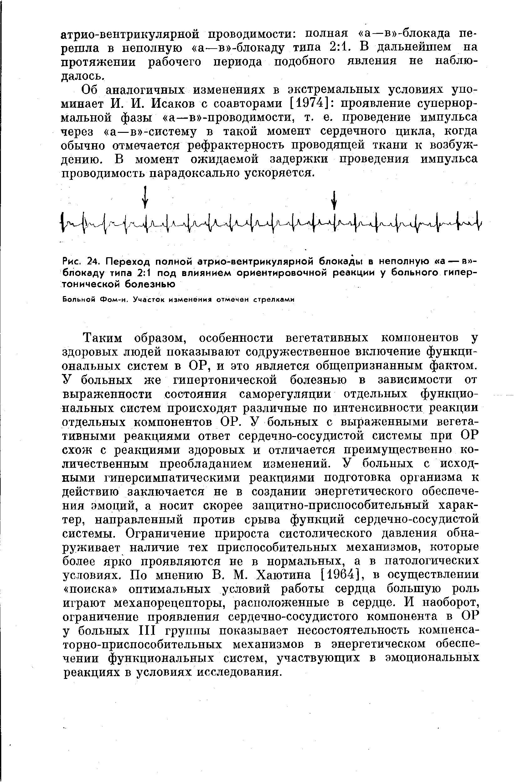 Рис. 24. Переход полной атрио-вентрикулярной блокады в неполную а — в -блокаду типа 2 1 под влиянием ориентировочной реакции у больного гипертонической болезнью...