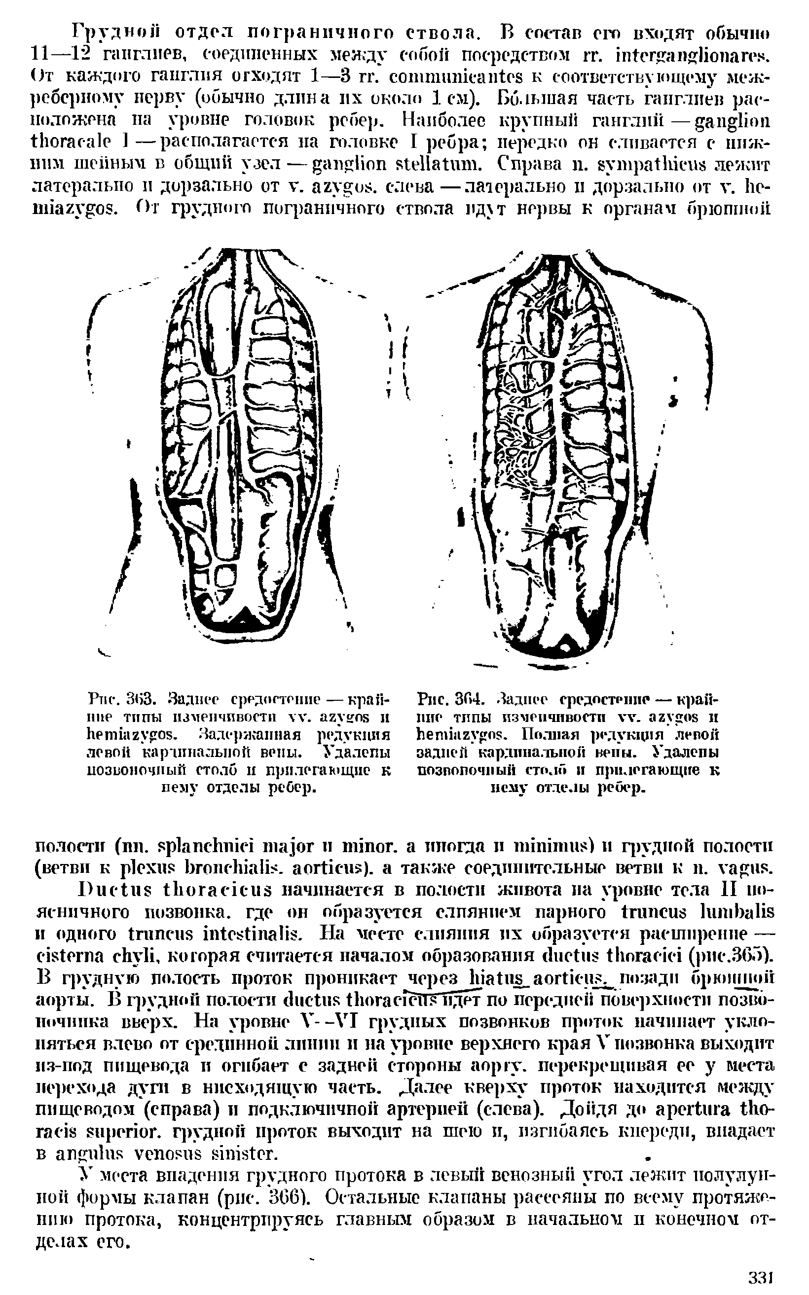 Рис. 364. Заднее средостение — крайние типы изменчивости . и . Полная редукция левой задней кардинальной вены. Удалепы позвоночный столб и прилегающие к нему отделы ребер.