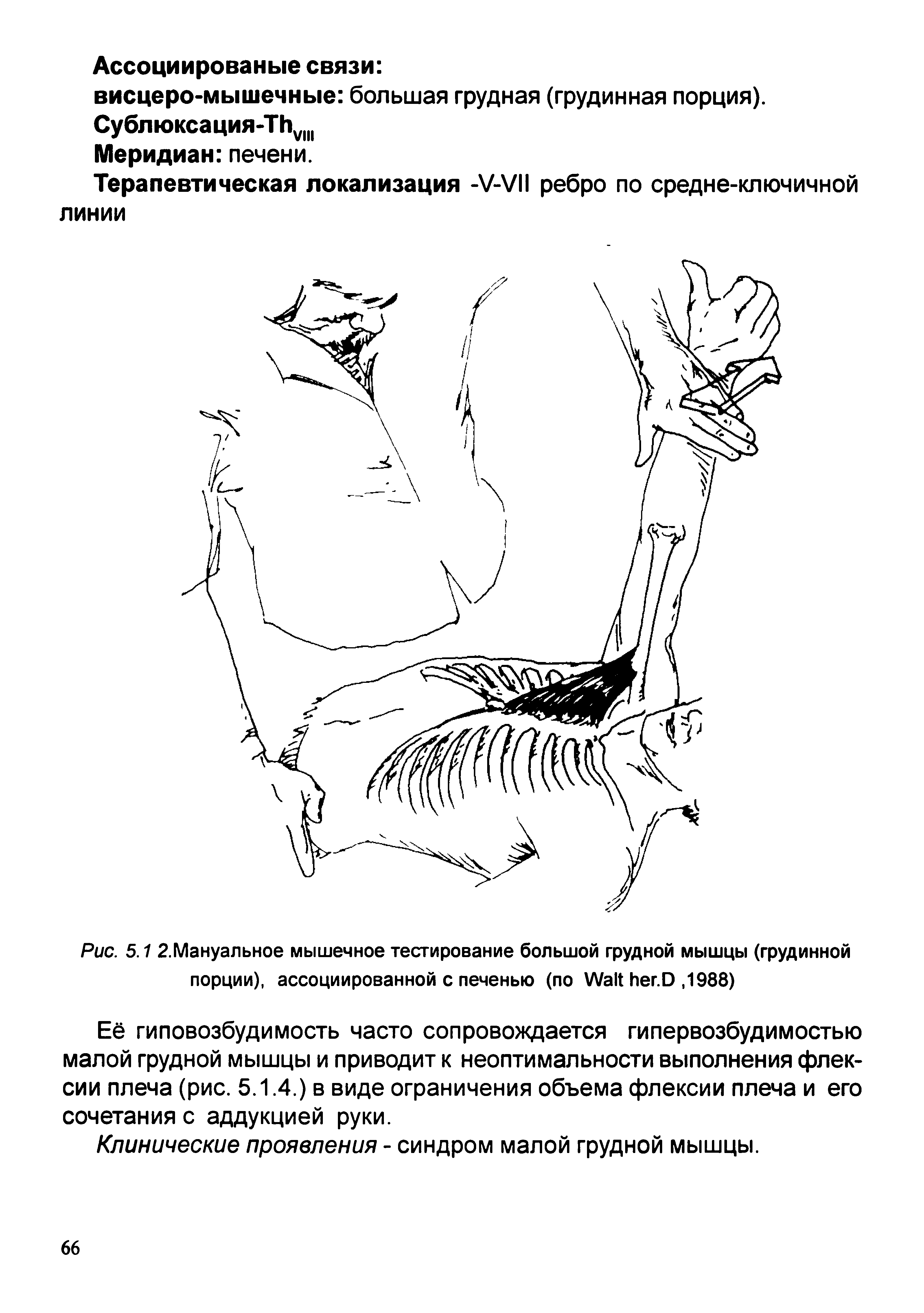 Рис. 5.1 2.Мануальное мышечное тестирование большой грудной мышцы (грудинной порции), ассоциированной с печенью (по Л/аИ Иег.О, 1988)...