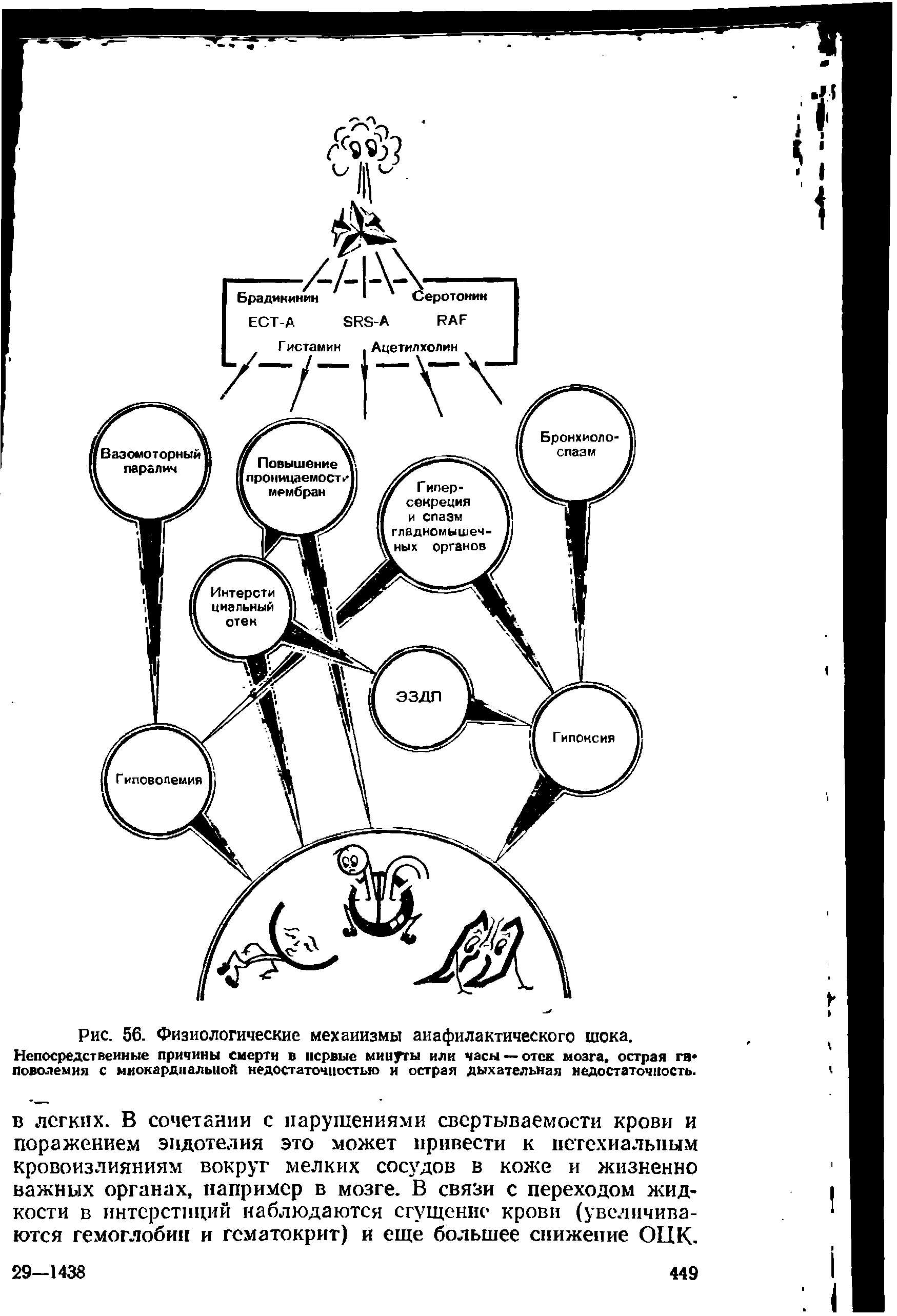 Рис. 56. Физиологические механизмы анафилактического шока. Непосредственные причины смерти в первые минуты или часы — отек мозга, острая га Поволемия с миокардиальной недостаточностью и острая дыхательная недостаточность.