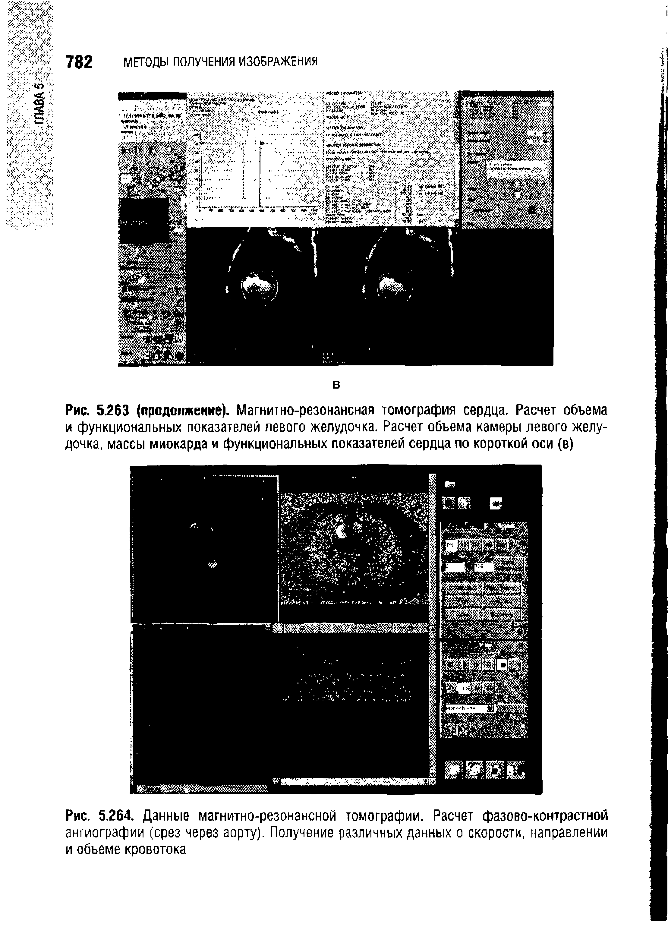 Рис. 5.264. Данные магнитно-резонансной томографии. Расчет фазово-контрастной ангиографии (срез через аорту). Получение различных данных о скорости, направлении и объеме кровотока...