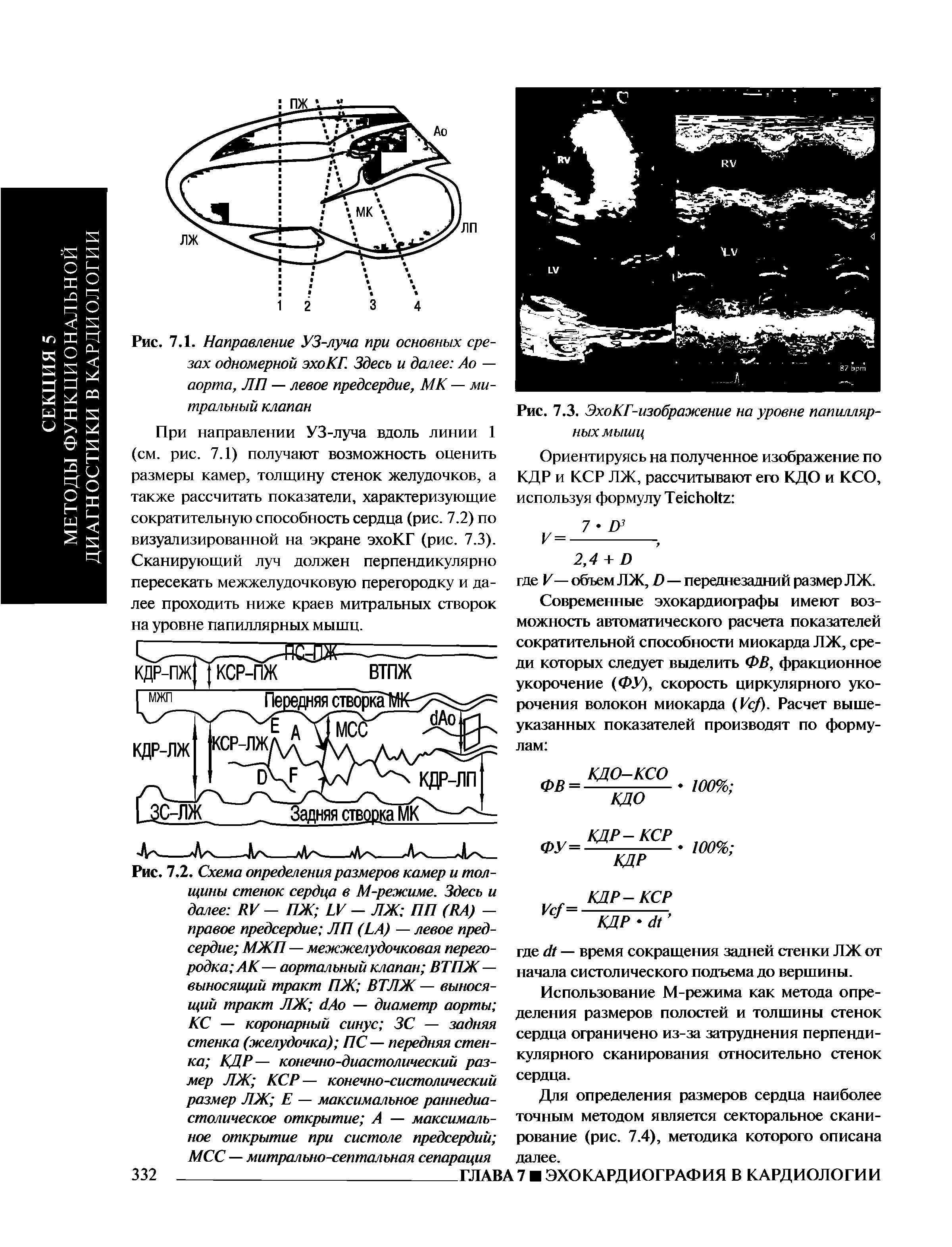 Рис. 7.2. Схема определения размеров камер и толщины стенок сердца в М-режиме. Здесь и далее ЛУ — ПЖ ЬУ — ЛЖ ПП (ЛА) — правое предсердие ЛП (ЬА) — левое предсердие МЖП — межжелудочковая перегородка АК-— аортальный клапан ВТПЖ— выносящий тракт ПЖ ВТЛЖ — выносящий тракт ЛЖ бАо — диаметр аорты КС — коронарный синус ЗС — задняя стенка (желудочка) ПС — передняя стенка КДР— конечно-диастолический размер ЛЖ КСР— конечно-систолический размер ЛЖ Е — максимальное раннедиастолическое открытие А — максимальное открытие при систоле предсердий ...