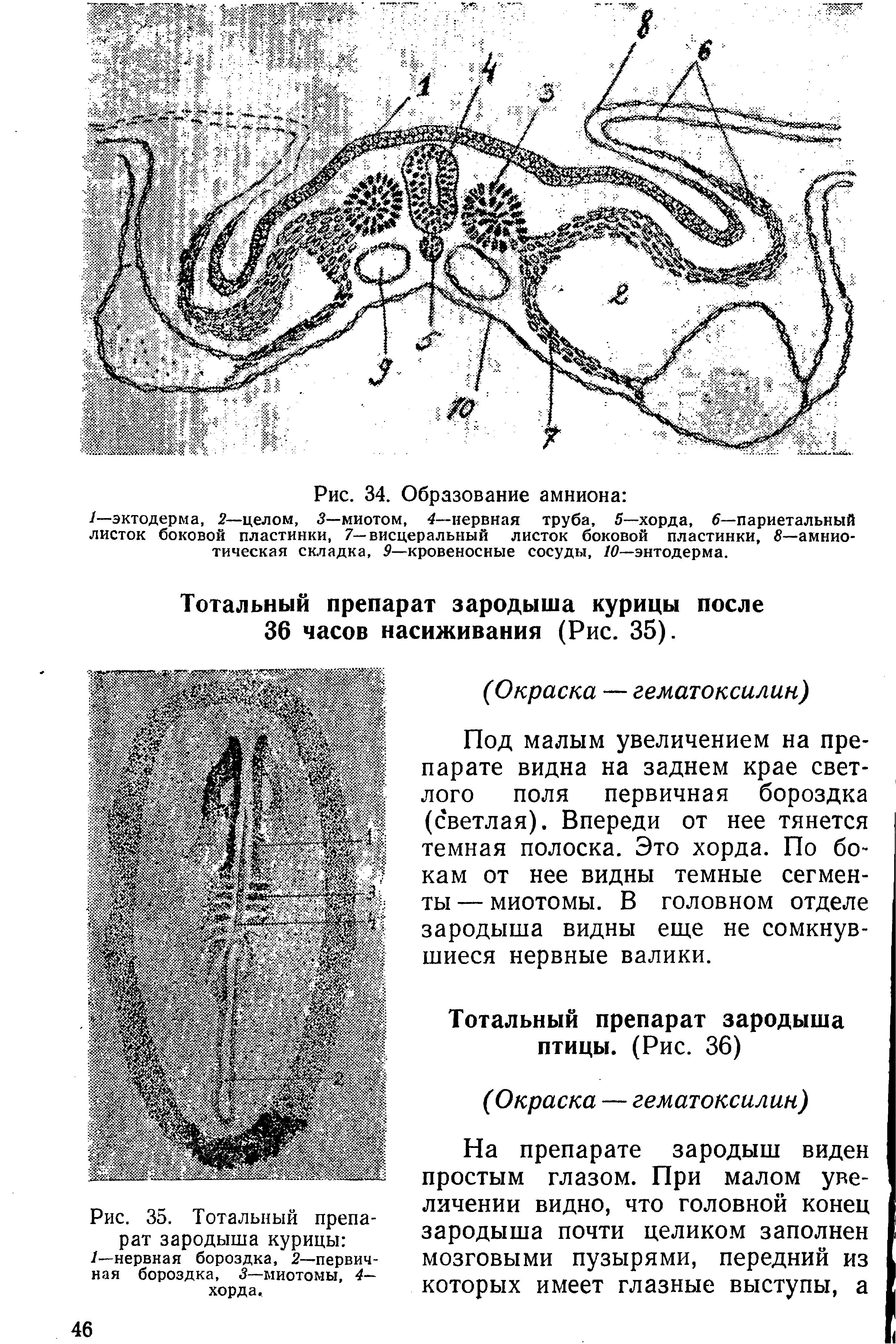 Рис. 35. Тотальный препарат зародыша курицы /—нервная бороздка, 2—первичная бороздка, 3—миотомы, 4— хорда.