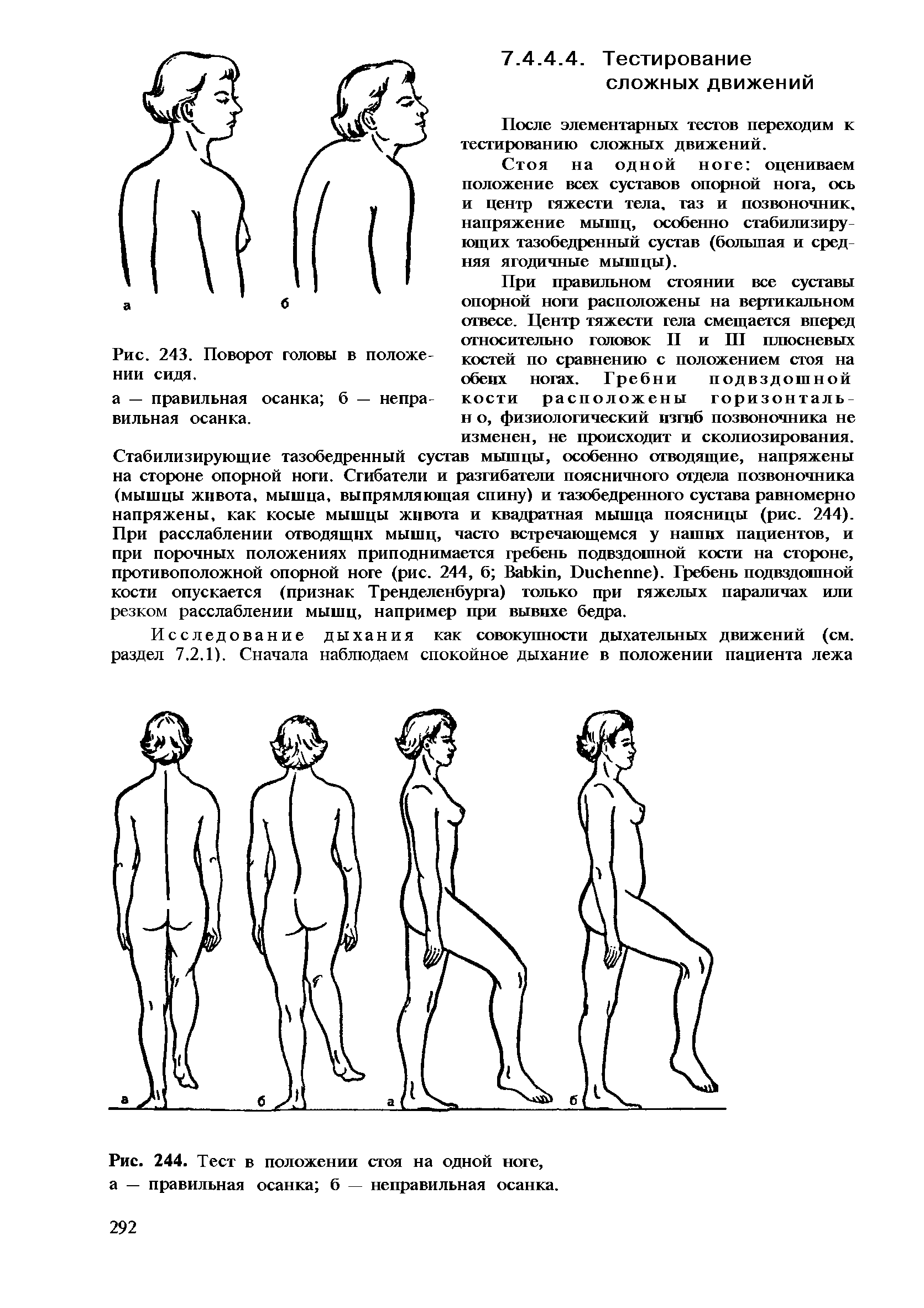 Рис. 244. Тест в положении стоя на одной ноге, а — правильная осанка б — неправильная осанка.