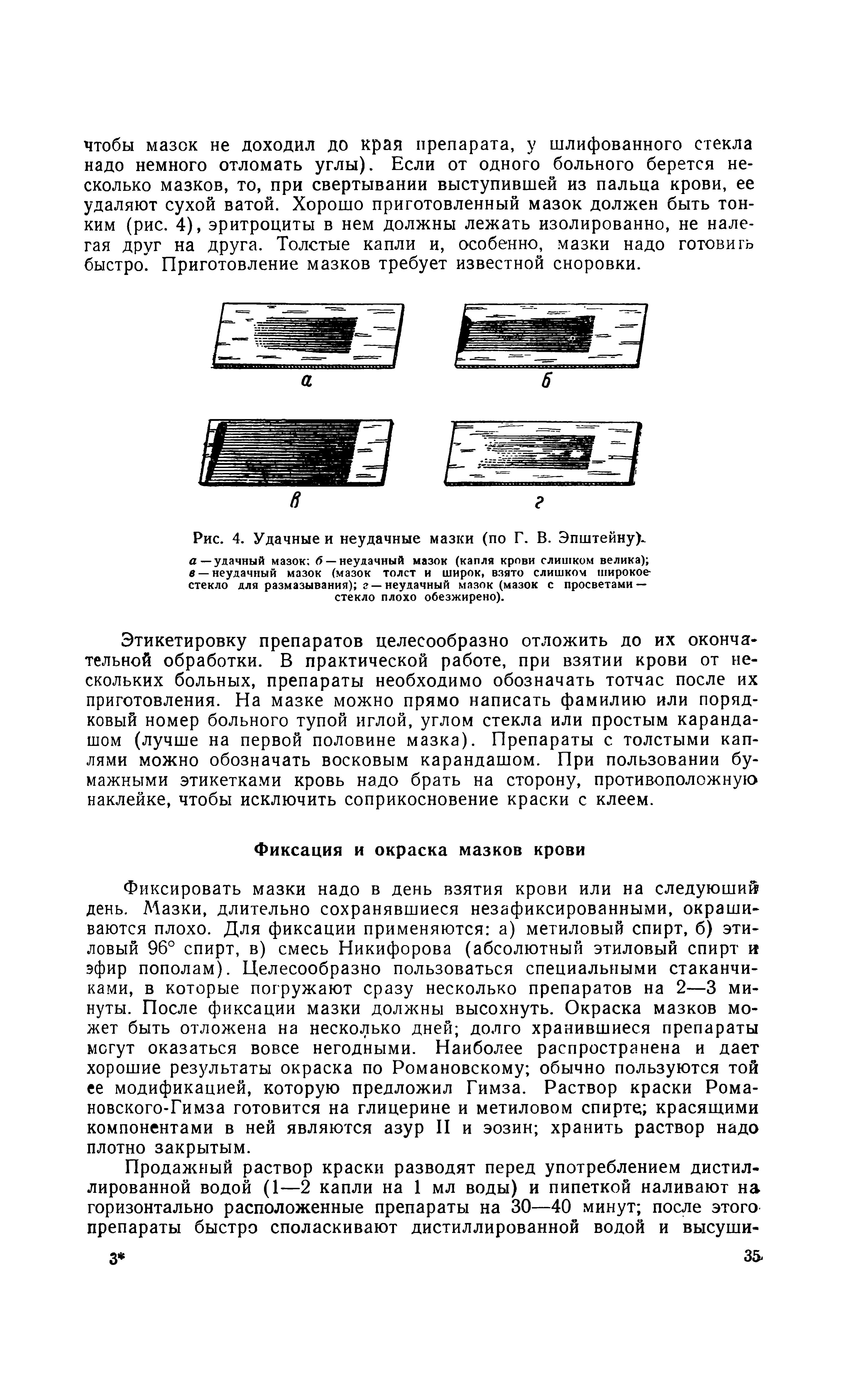 Рис. 4. Удачные и неудачные мазки (по Г. В. Эпштейну)-, а—удачный мазок б — неудачный мазок (капля крови слишком велика) в —неудачный мазок (мазок толст и широк, взято слишком широкое-стекло для размазывания) г —неудачный мазок (мазок с просветами — стекло плохо обезжирено).