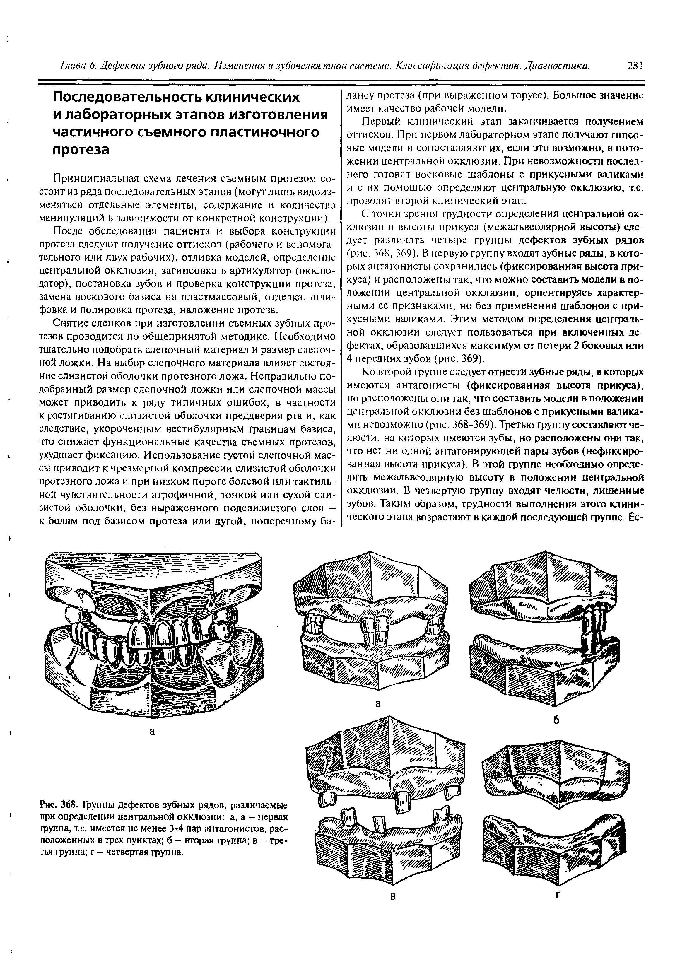 Рис. 368. Группы дефектов зубных рядов, различаемые при определении центральной окклюзии а, а - первая группа, т.е. имеется не менее 3-4 пар антагонистов, расположенных в трех пунктах б - вторая группа в - третья группа г - четвертая группа.