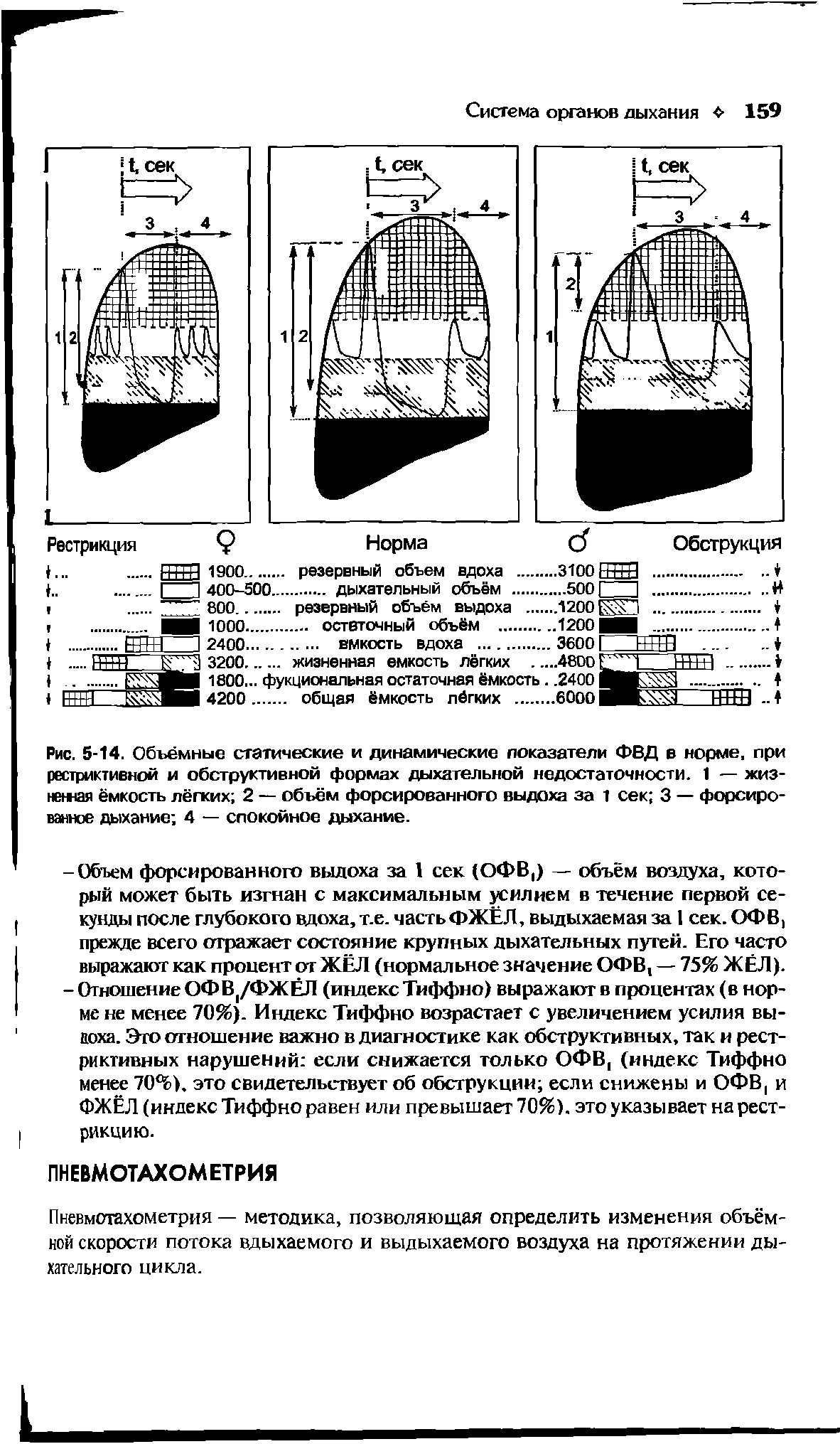 Рис. 5-14. Объёмные статические и динамические показатели ФВД в норме, при рестриктивной и обструктивной формах дыхательной недостаточности. 1 — жизненная ёмкость лёгких 2 — объём форсированного выдоха за 1 сек 3 — форсированное дыхание 4 — спокойное дыхание.