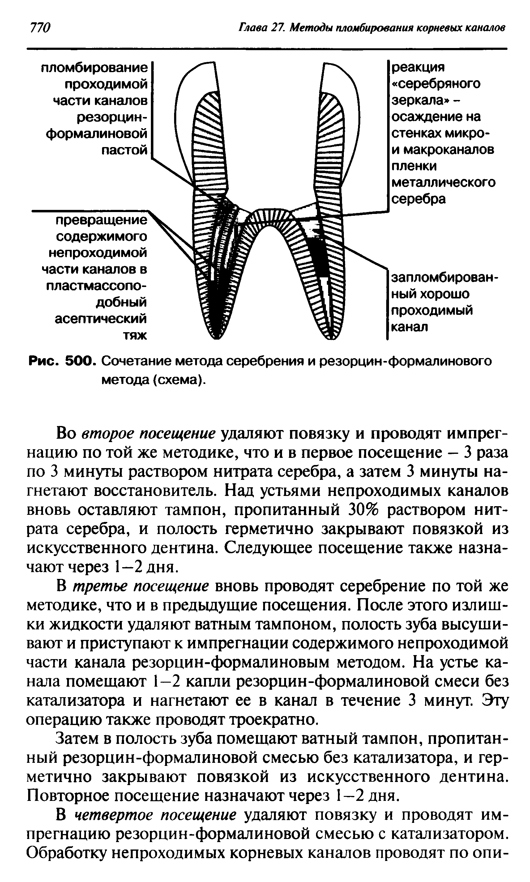 Рис. 500. Сочетание метода серебрения и резорцин-формалинового метода (схема).